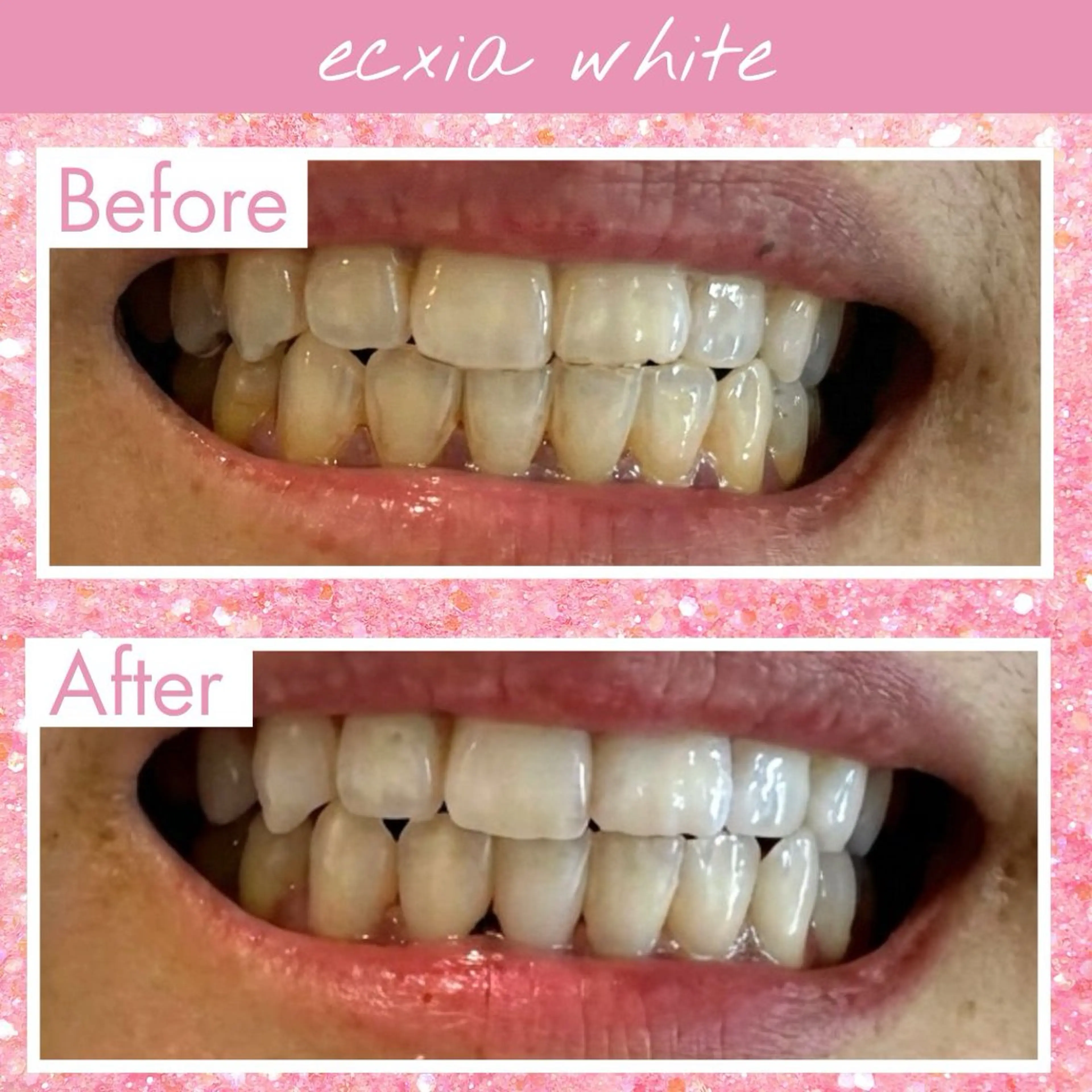 その他 エクシアホワイト福岡六本松所属・喜多 美佳のその他イメージ