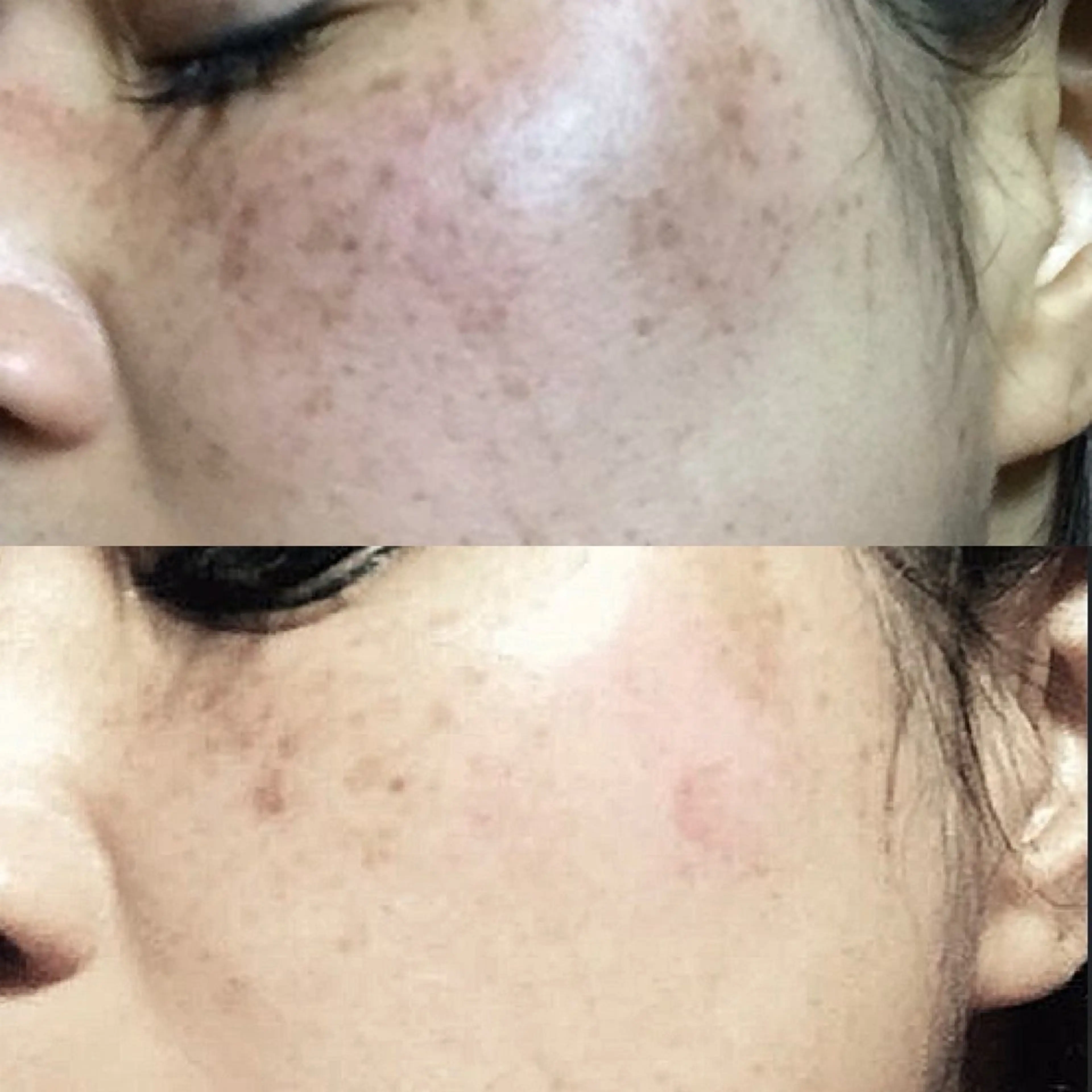 AtelierRin Ayumiのマツエク・マツパデザイン