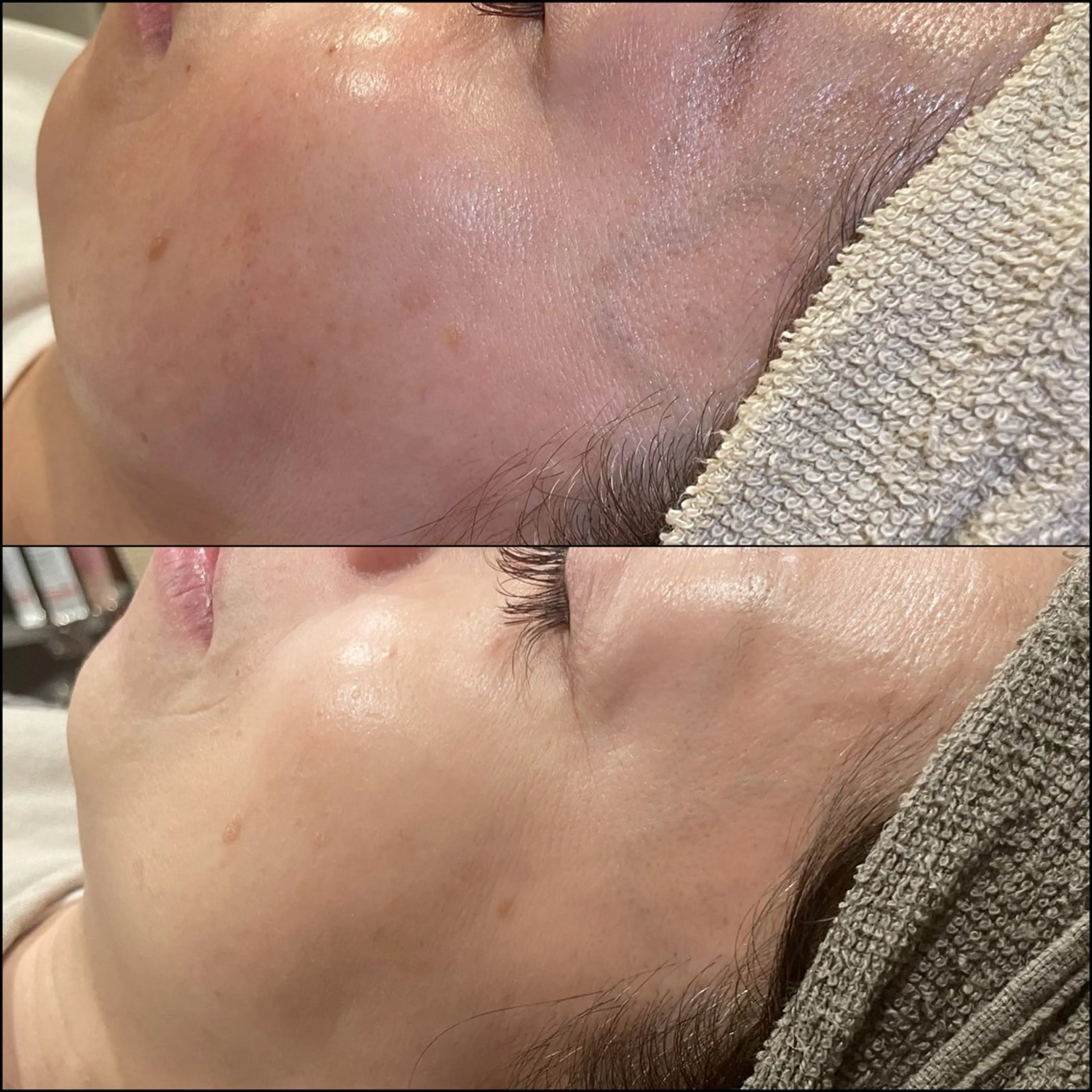 エステ LiZA エステティックサロンのエステ・リラクイメージ