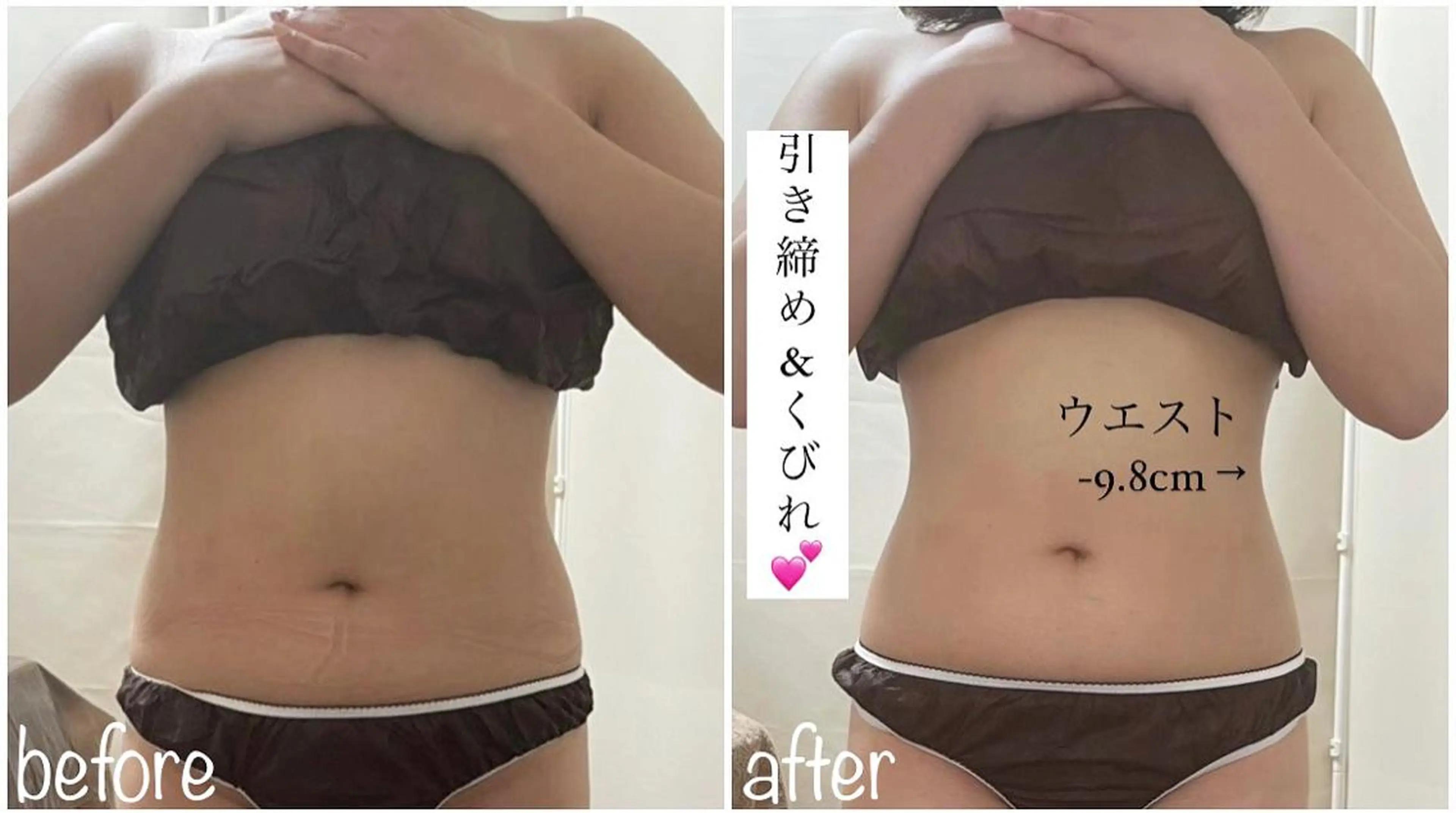 《本気痩せ×疲労改善 》  BILOOPのエステ・リラクイメージ