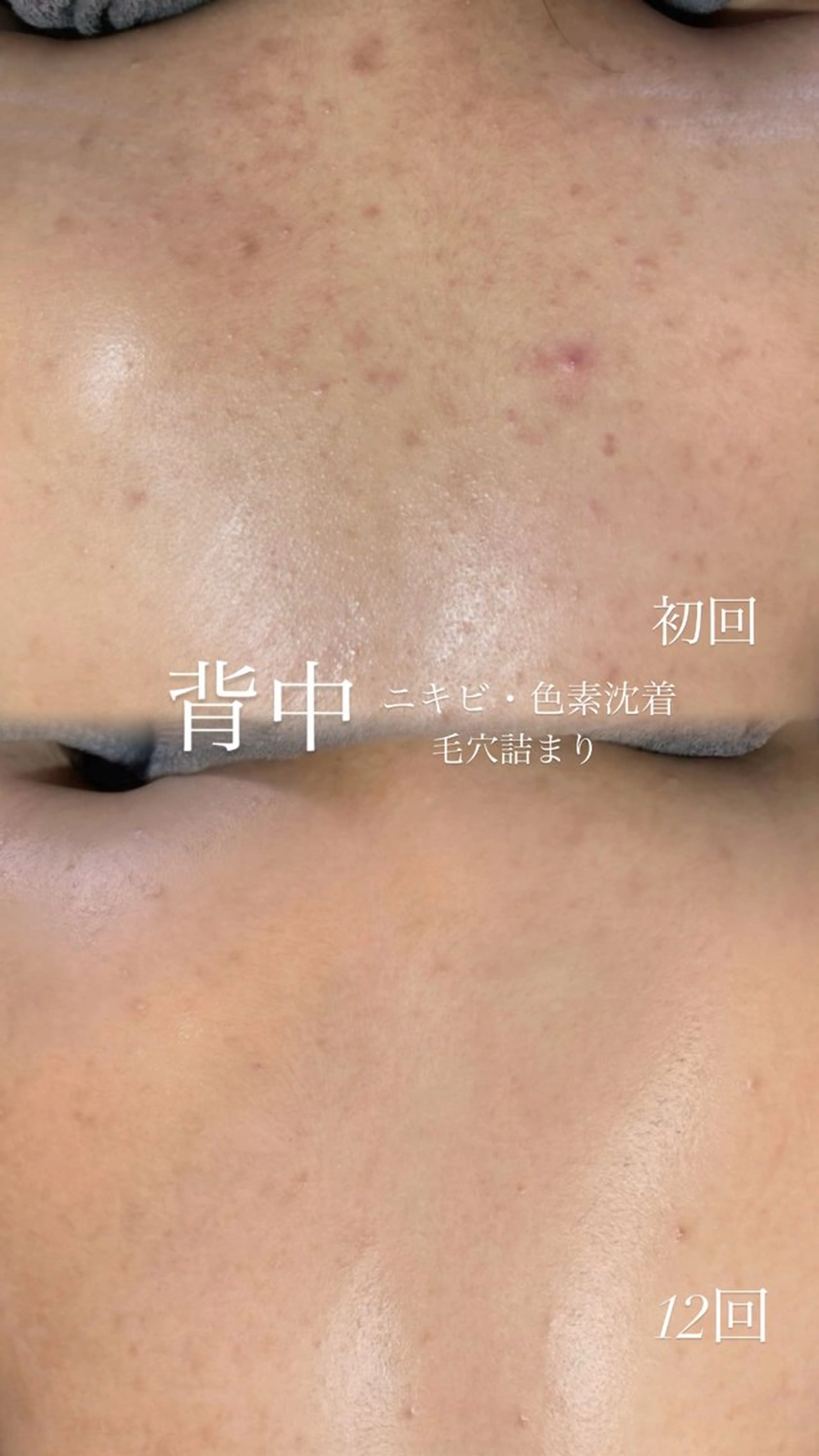 エステ 艶肌デトックス🫧 Samiraのエステ・リラクイメージ