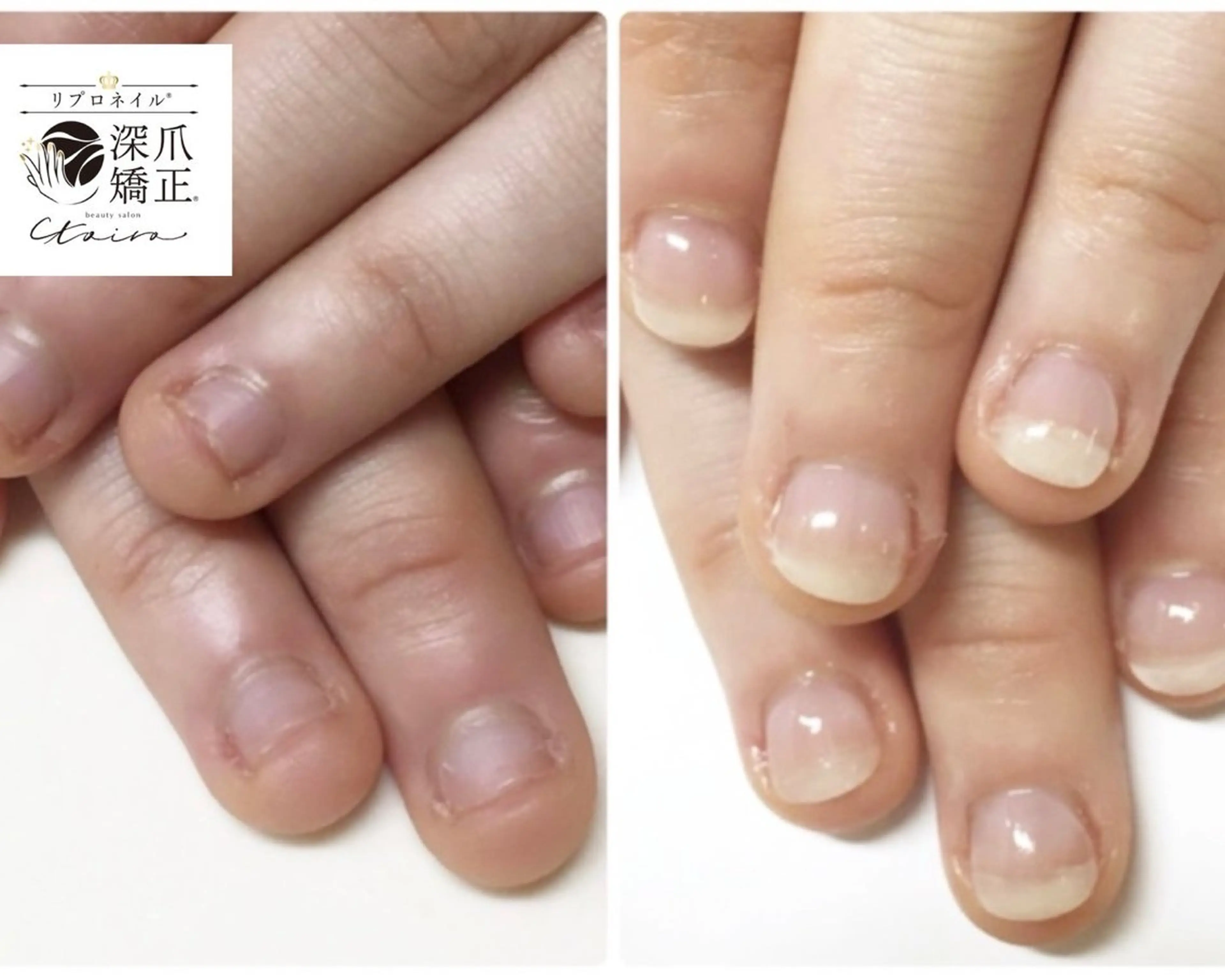 メンズ ネイル フットネイル ネイルサロン トイロのネイルデザイン