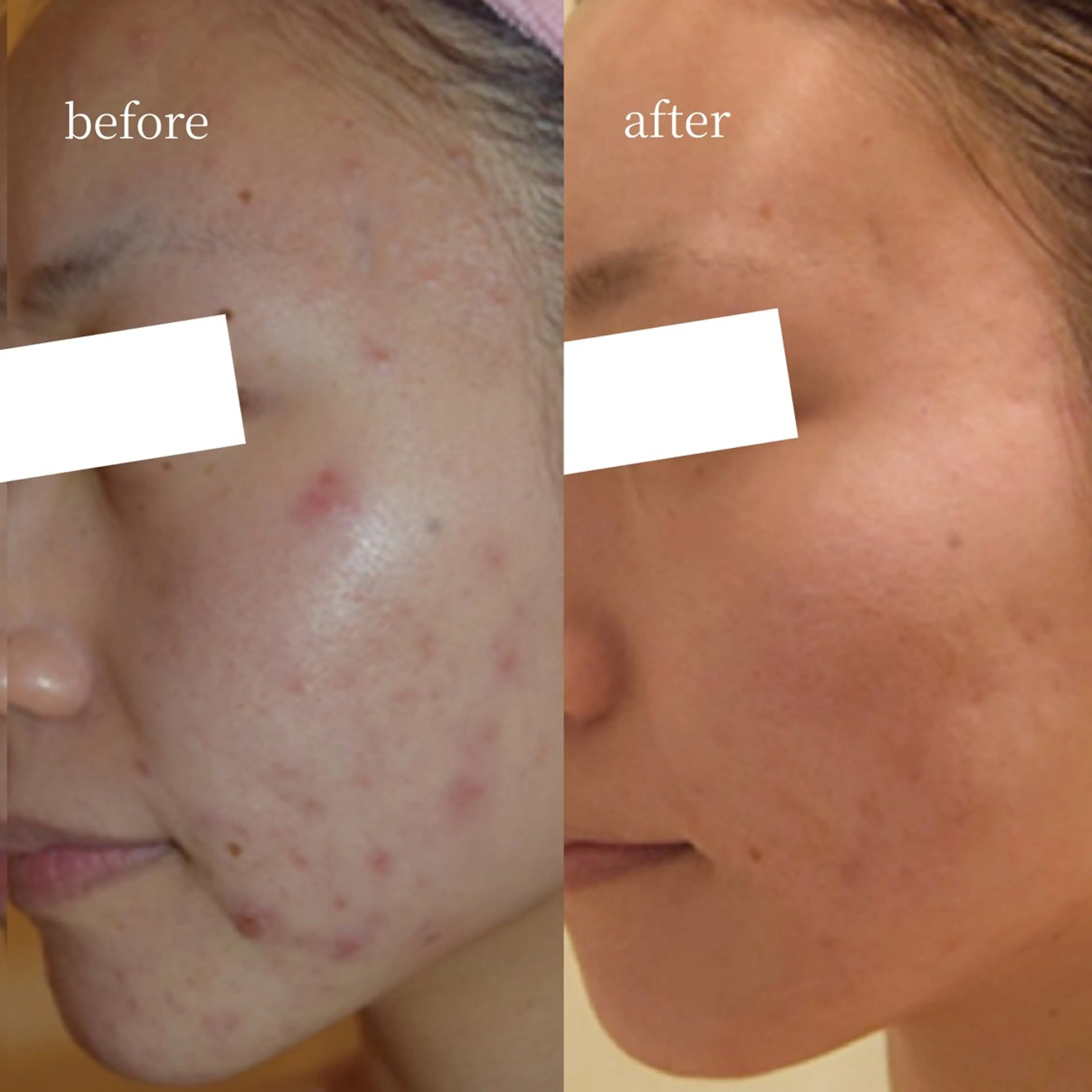 エステ 韓国肌管理・肌質改善 EARNEST心斎橋のエステ・リラクイメージ