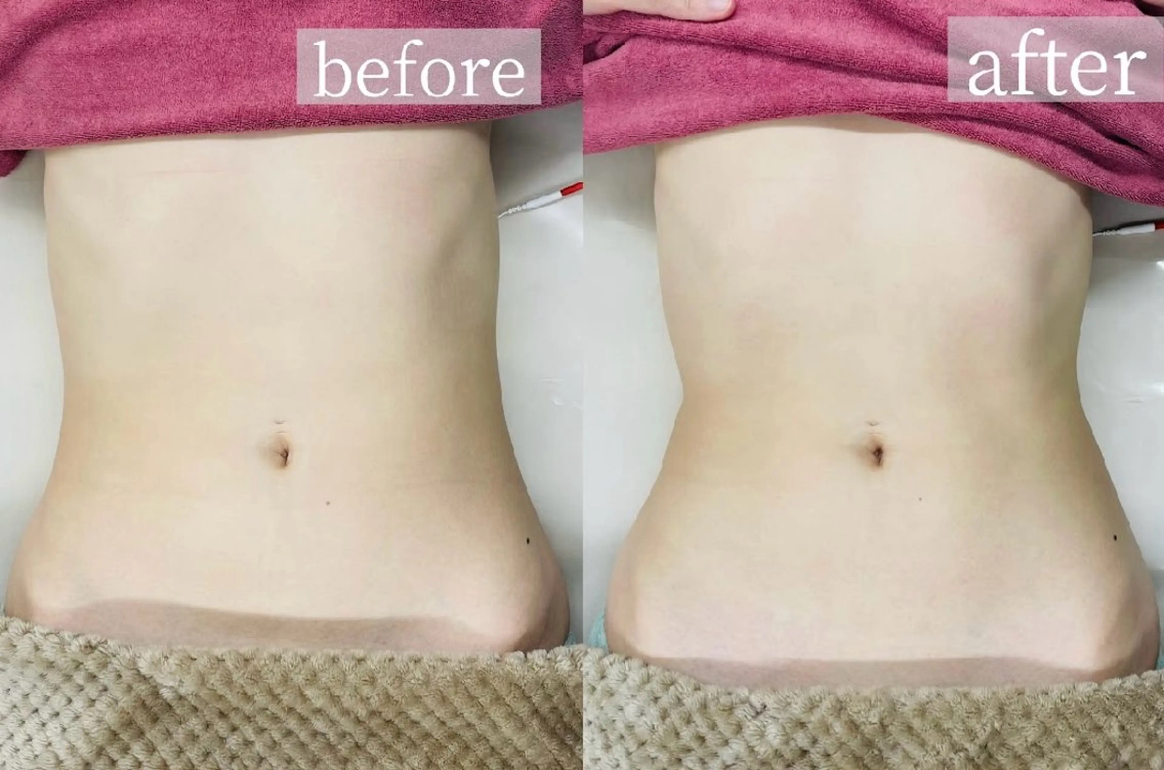 エステ 山口 夏生のエステ・リラクイメージ