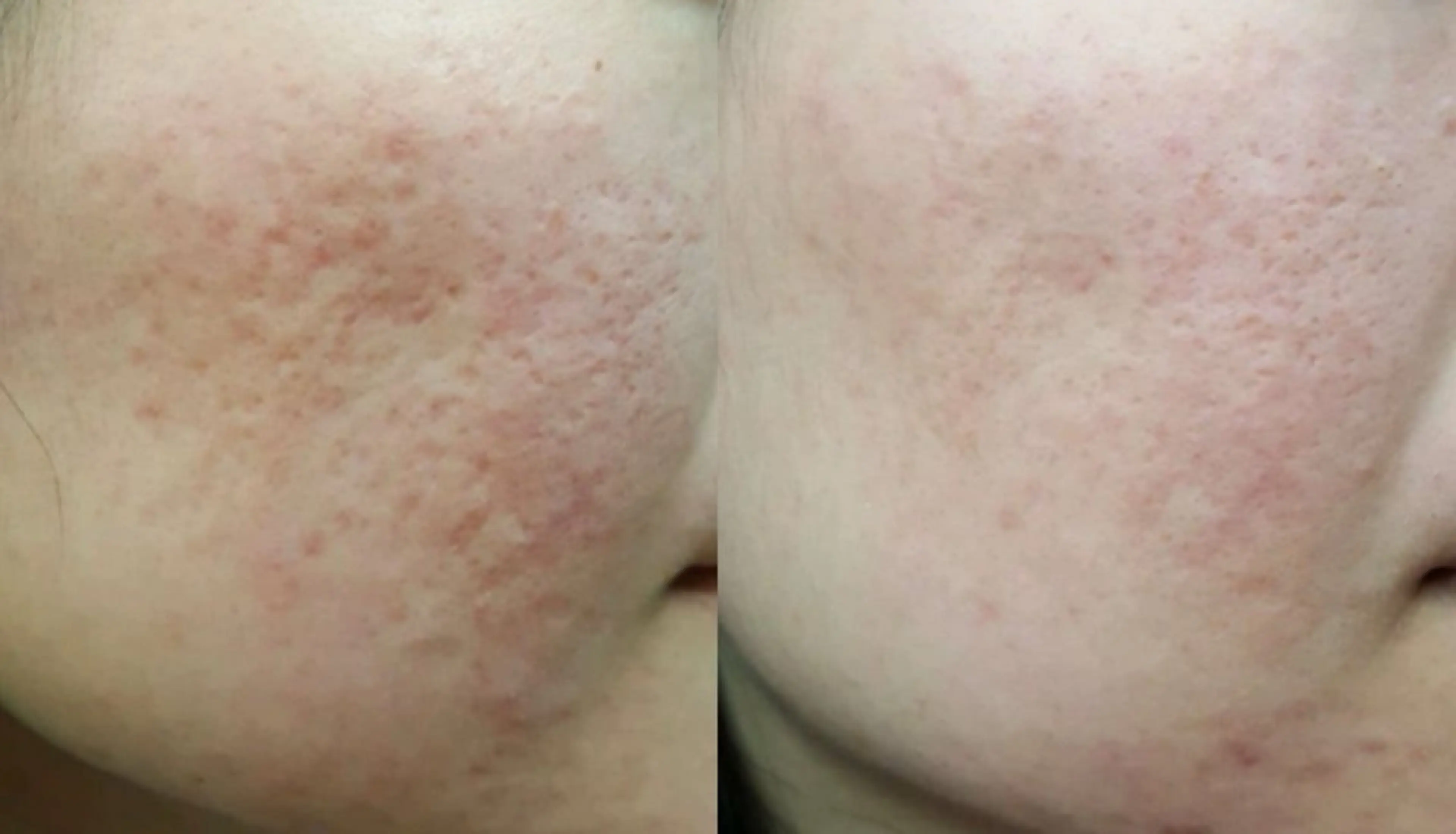 ショート エステ リラク 愛維美水光美肌専門店 メンズレディースokのエステ・リラクイメージ