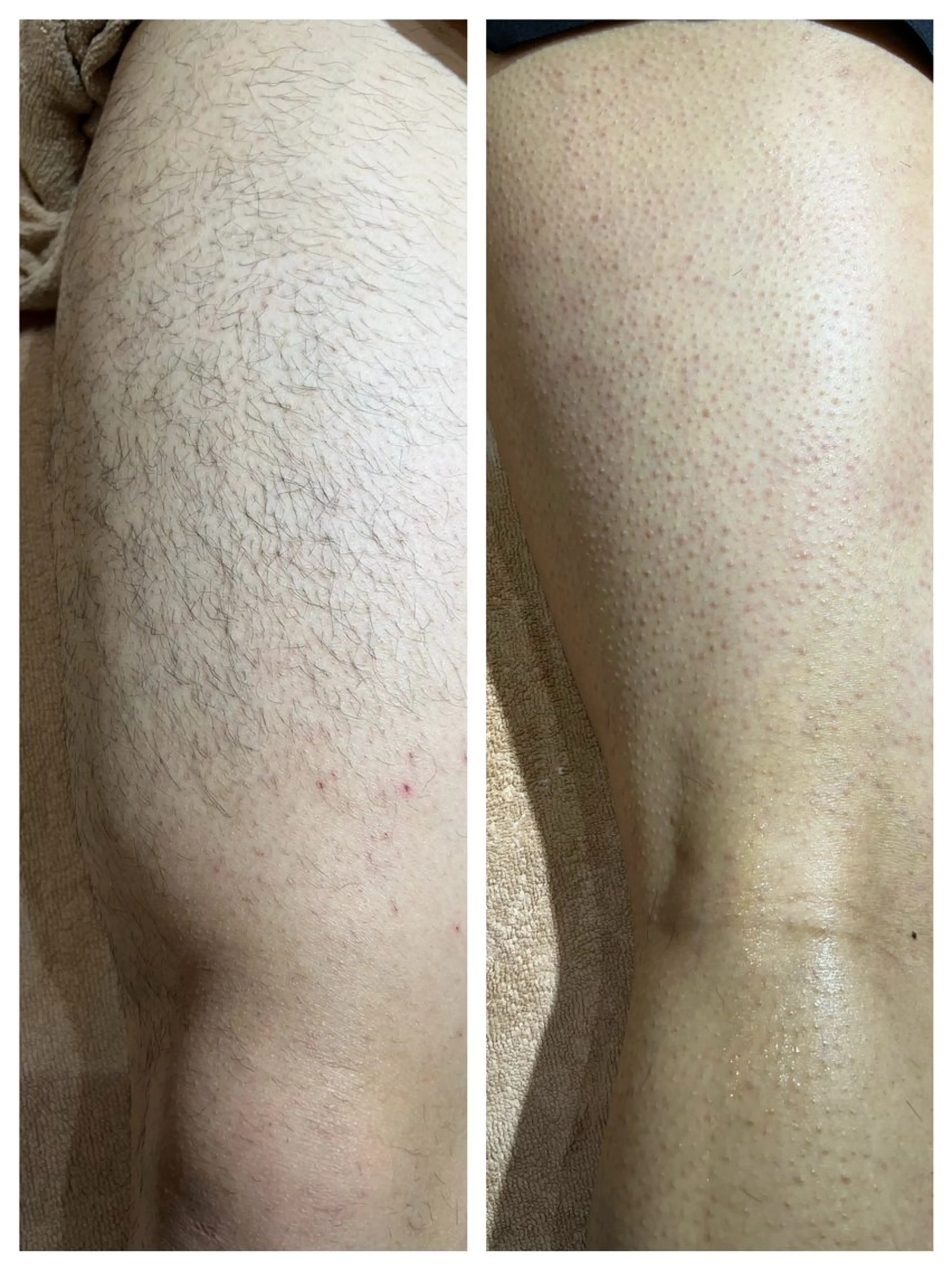 HIKARI a.k.a 神童♡のエステ・リラクイメージ