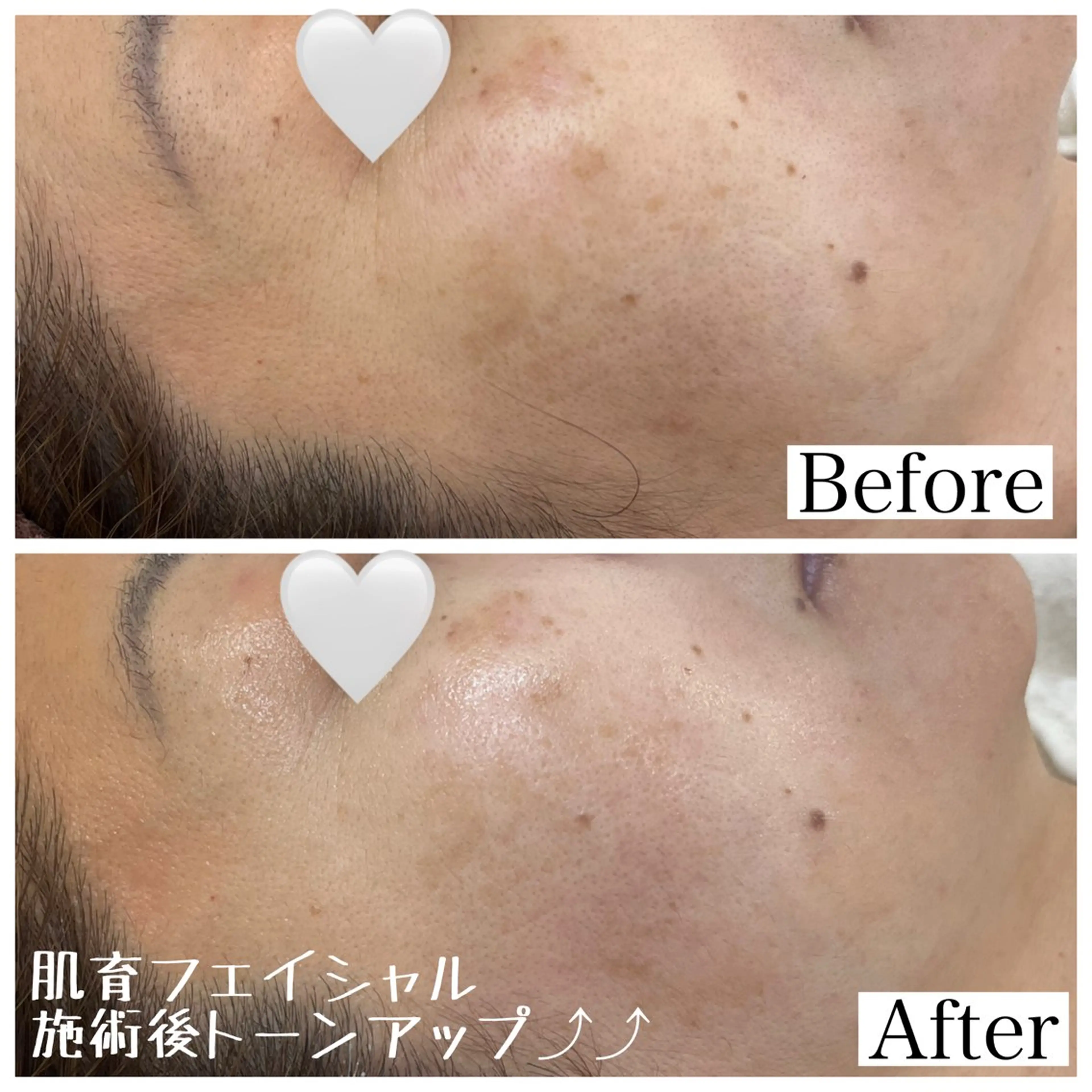 【脱毛と肌育のお店】 sharan✨✨のエステ・リラクイメージ