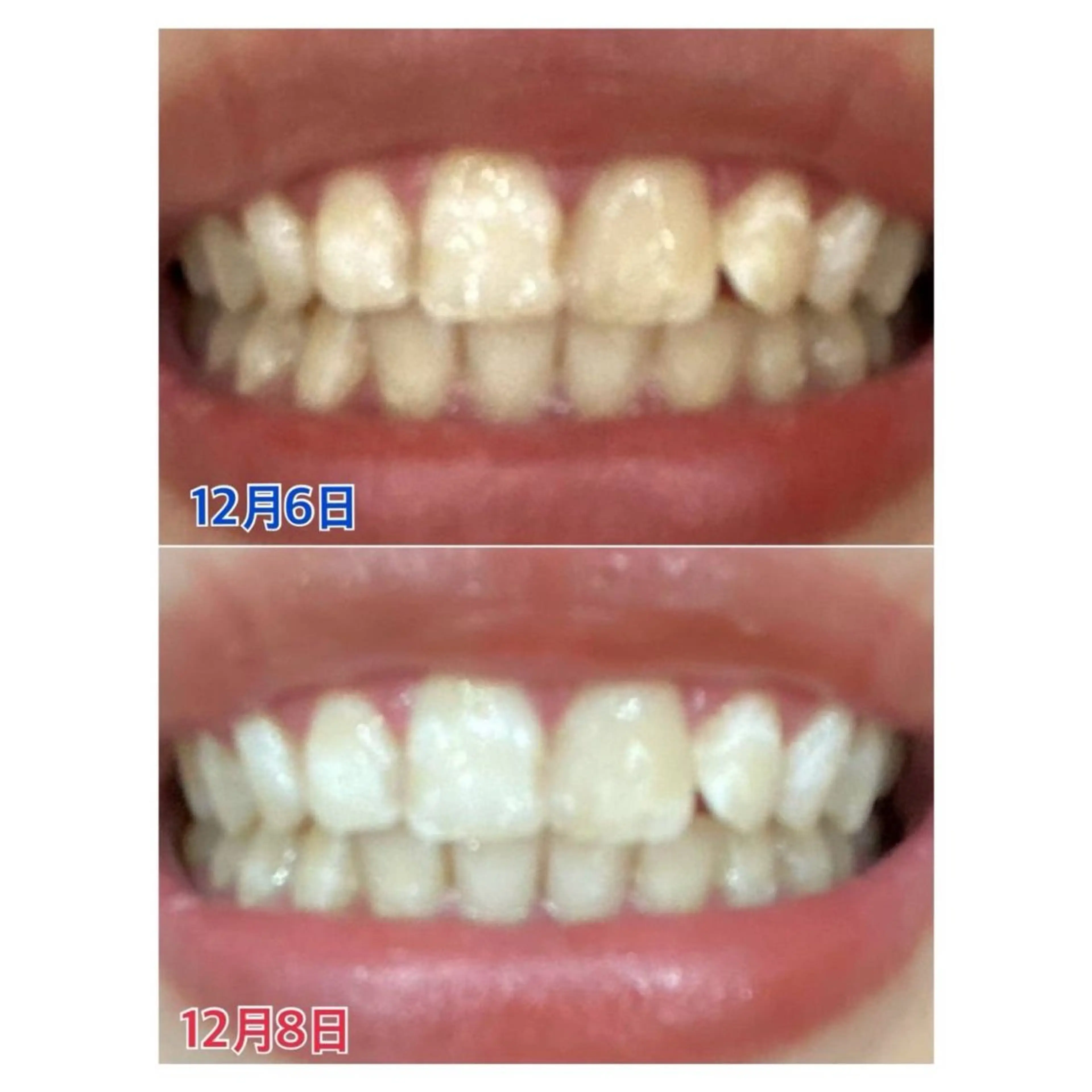 Melty 輝のその他イメージ