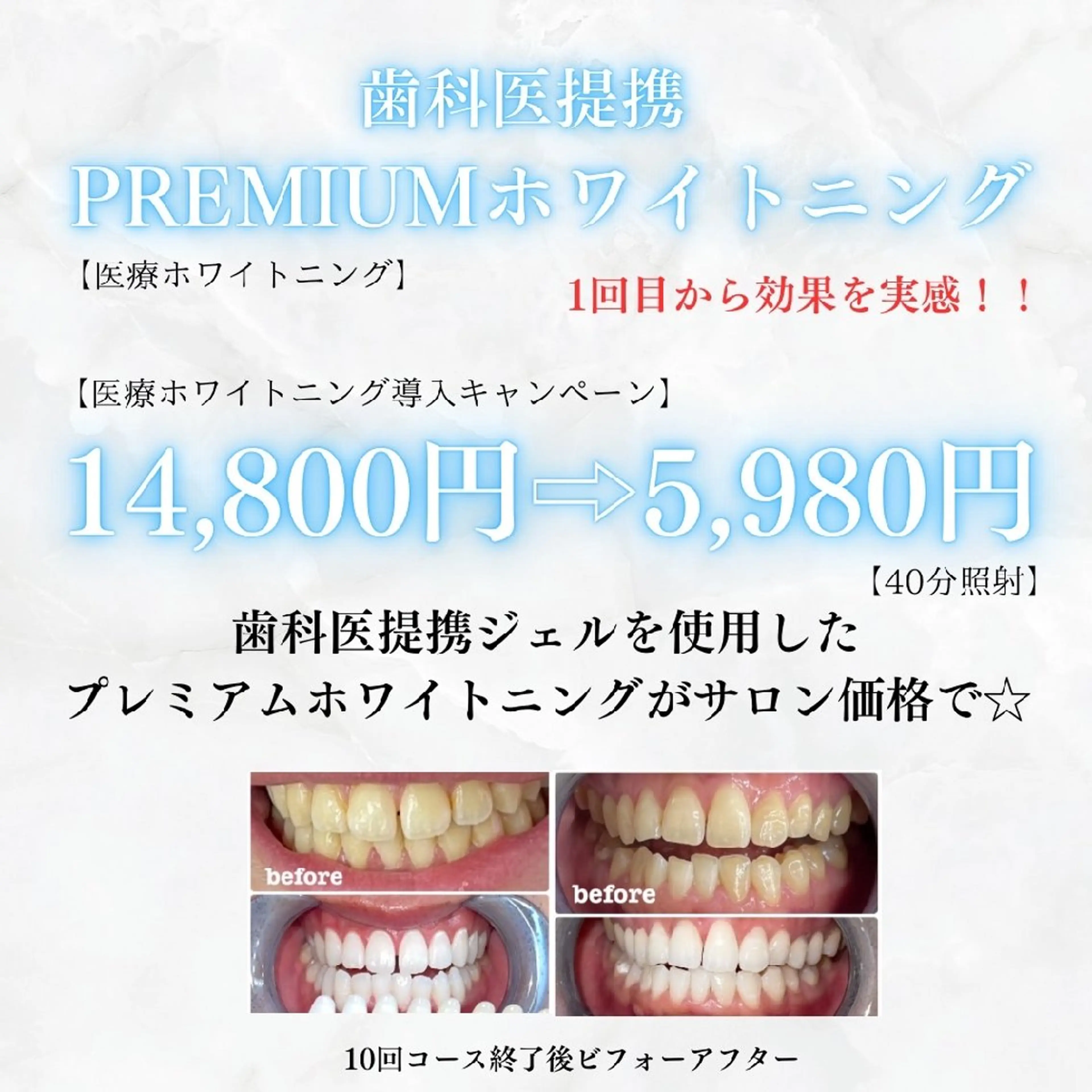 メンズ セルフホワイトニング WHITE福岡博多店のエステ・リラクイメージ