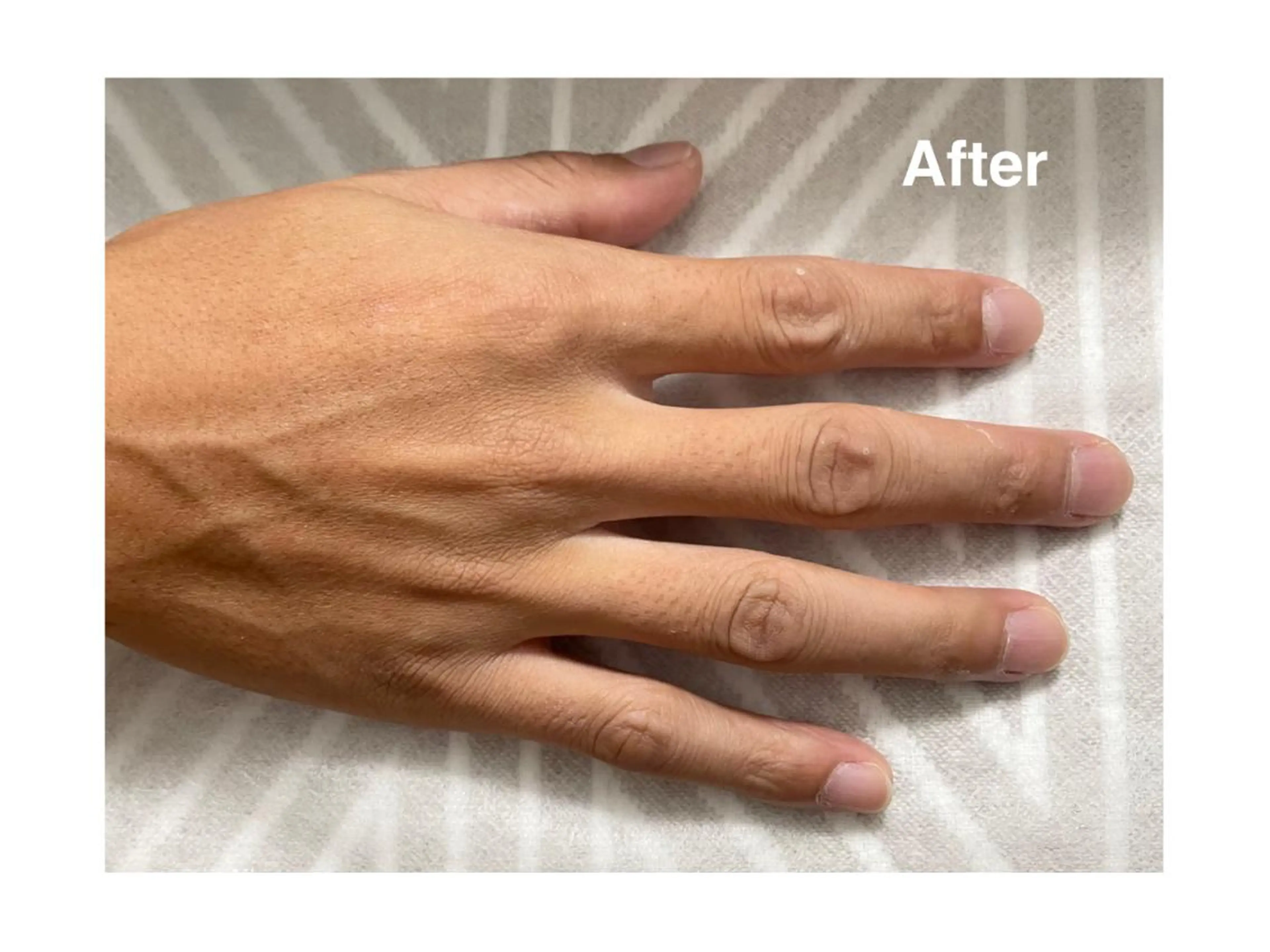 地上のトレチカ sugaringのエステ・リラクイメージ