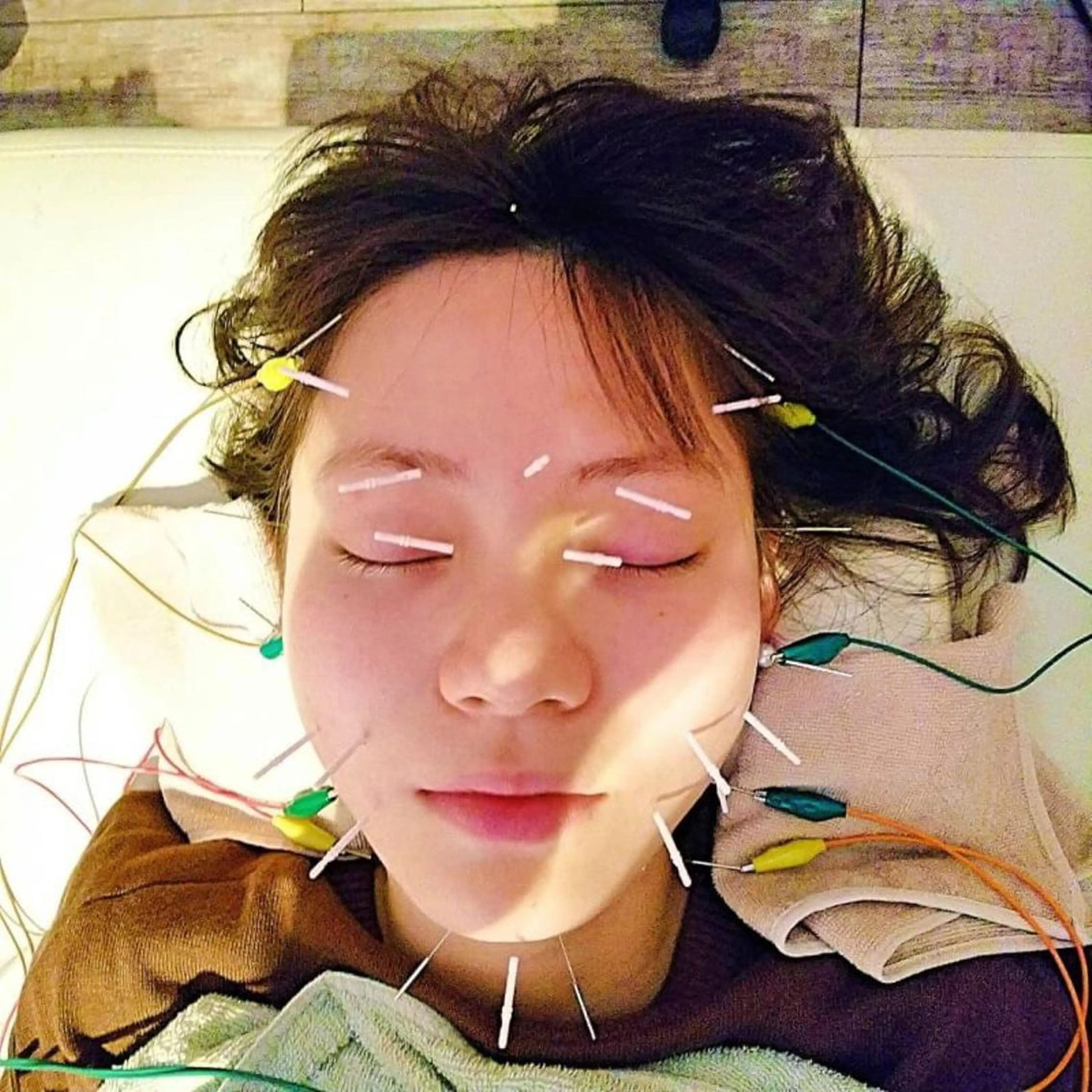 むくみたるみ専門☆ 美容鍼・小顔矯正のエステ・リラクイメージ