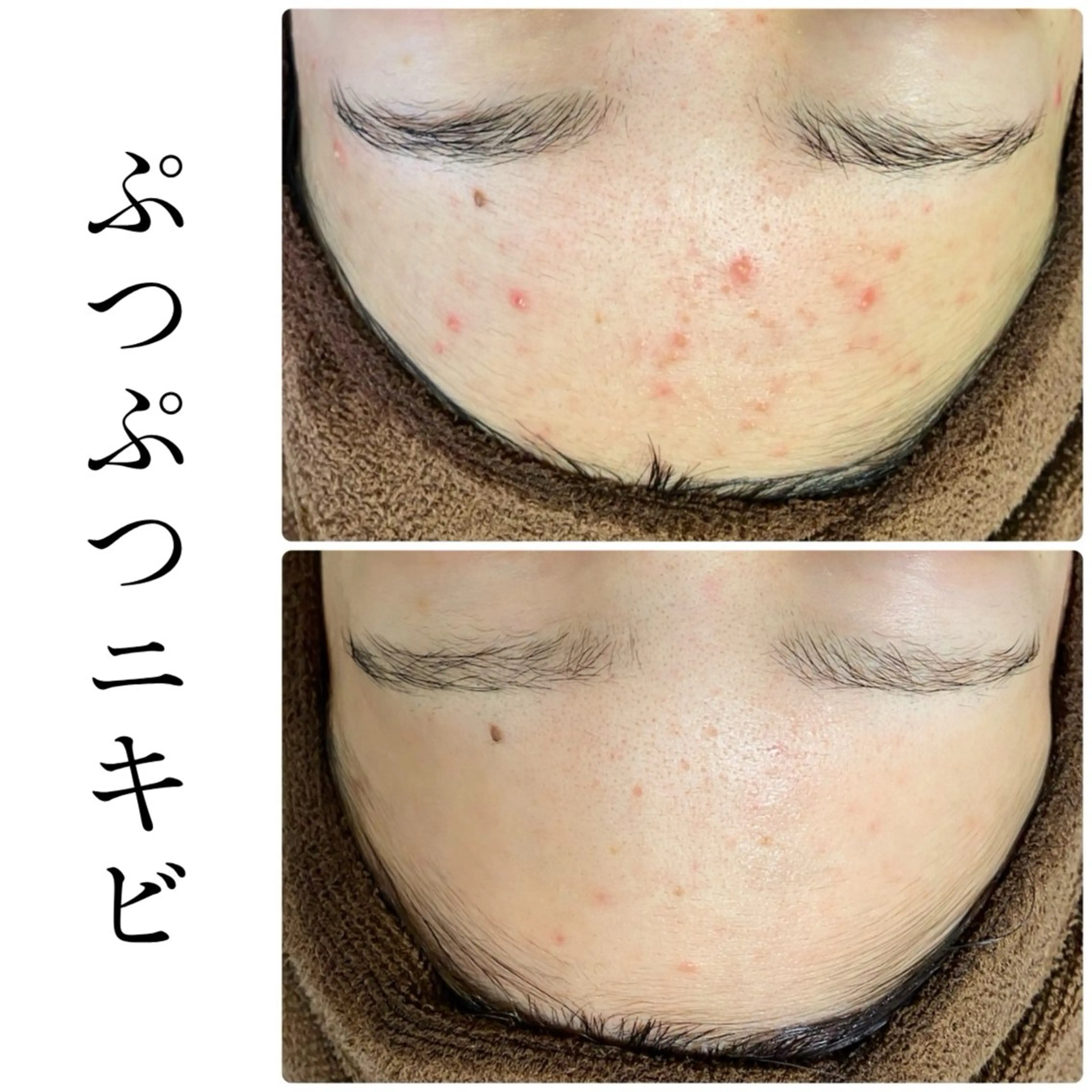 エステ ハーブピーリング専門 BIOEL横浜のエステ・リラクイメージ