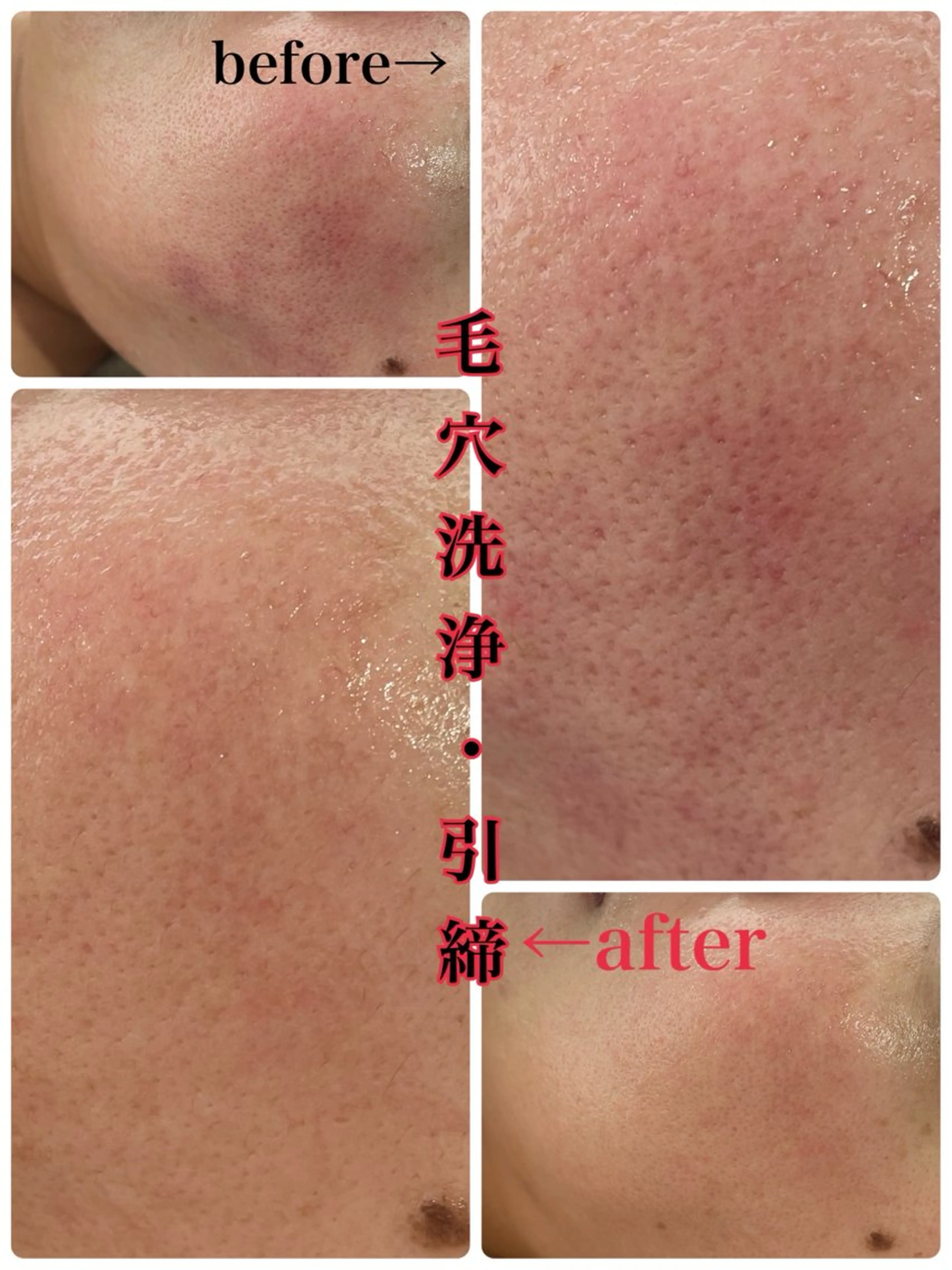 RISE beaut y salonのエステ・リラクイメージ