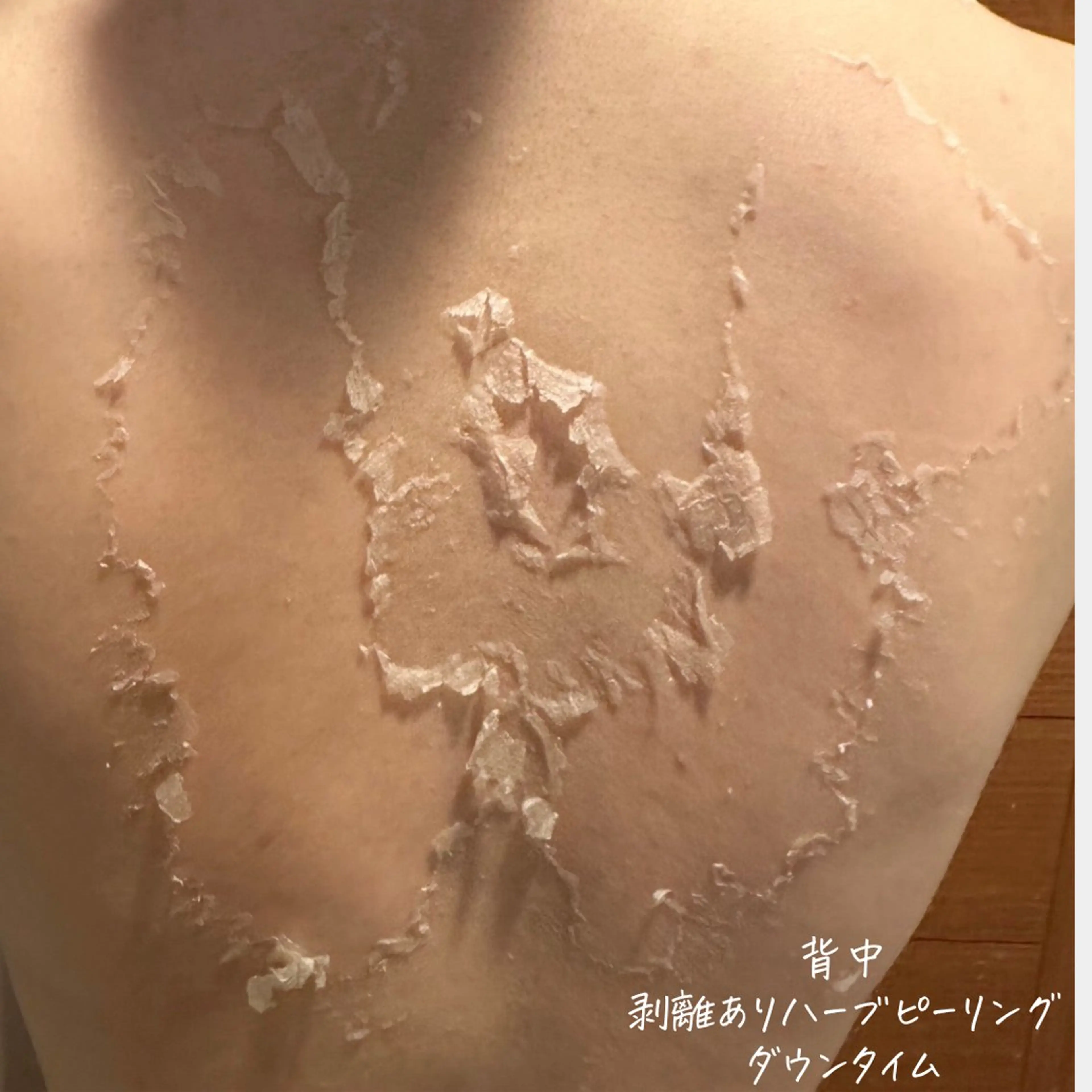 肌質改善サロン renew/ｳｴｷのエステ・リラクイメージ