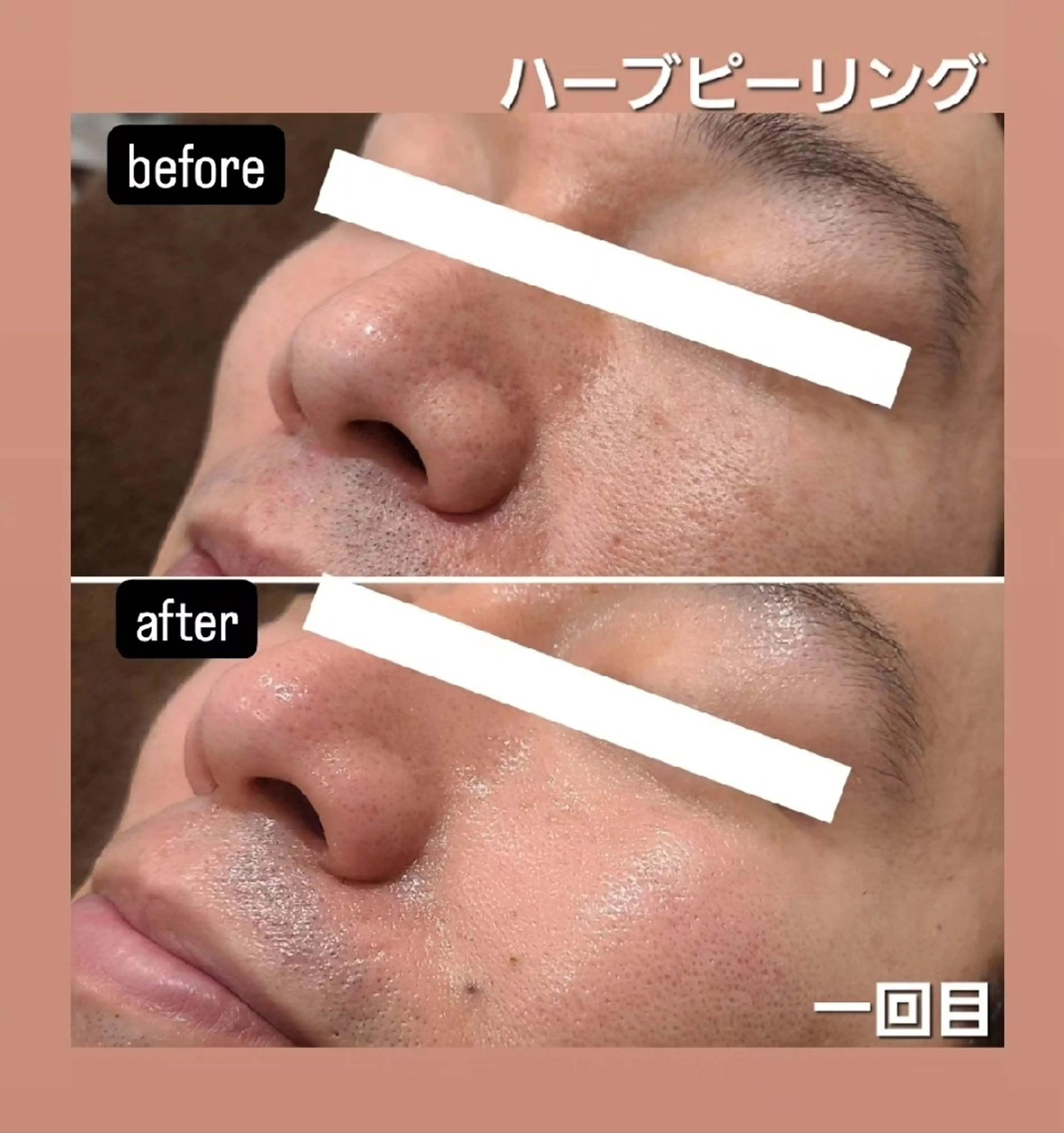 エステ BEAUTYSARON　SiS.所属・高橋 沙奈江のエステ・リラクイメージ