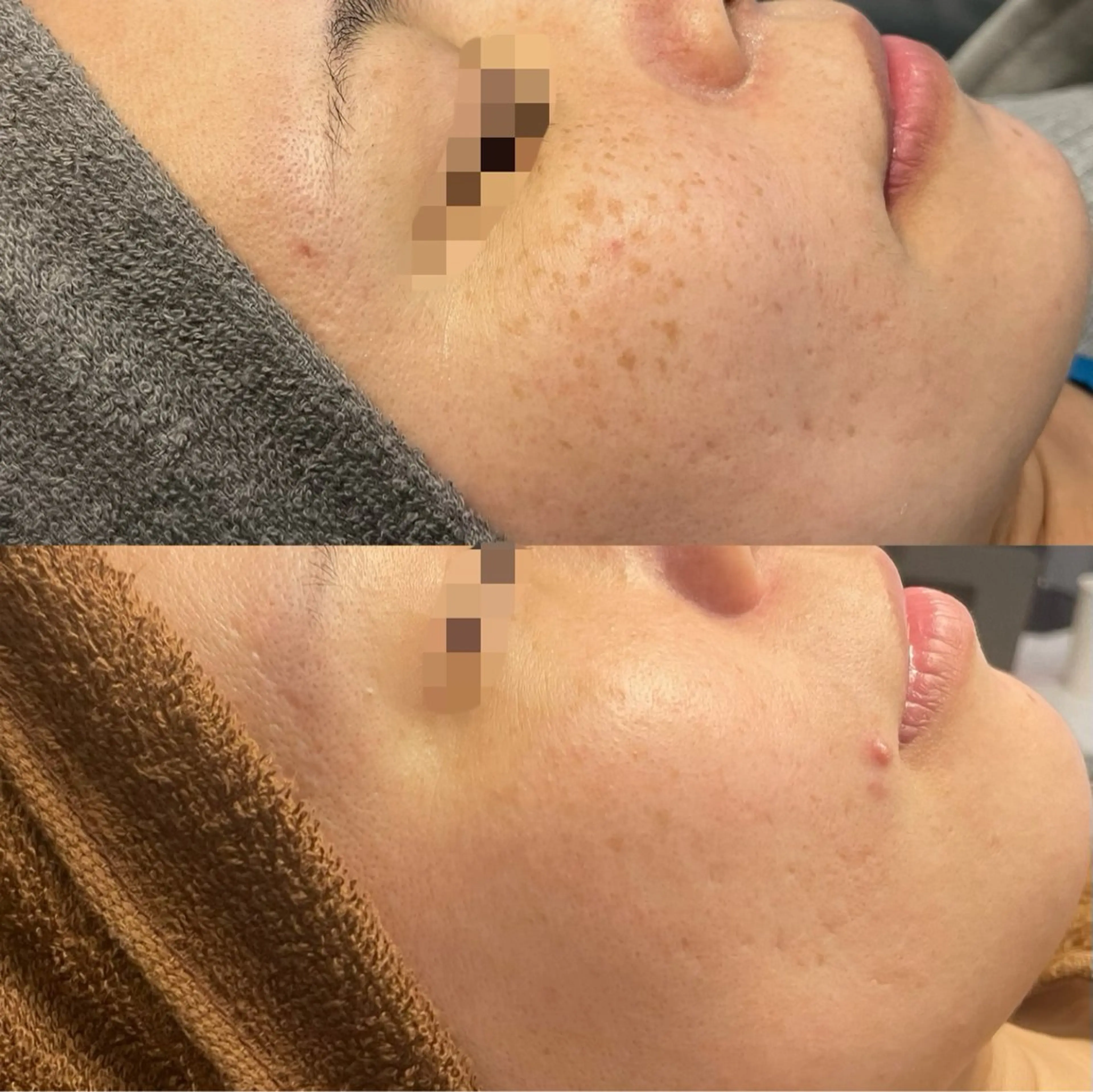 シミケア専門店 モルセラのエステ・リラクイメージ