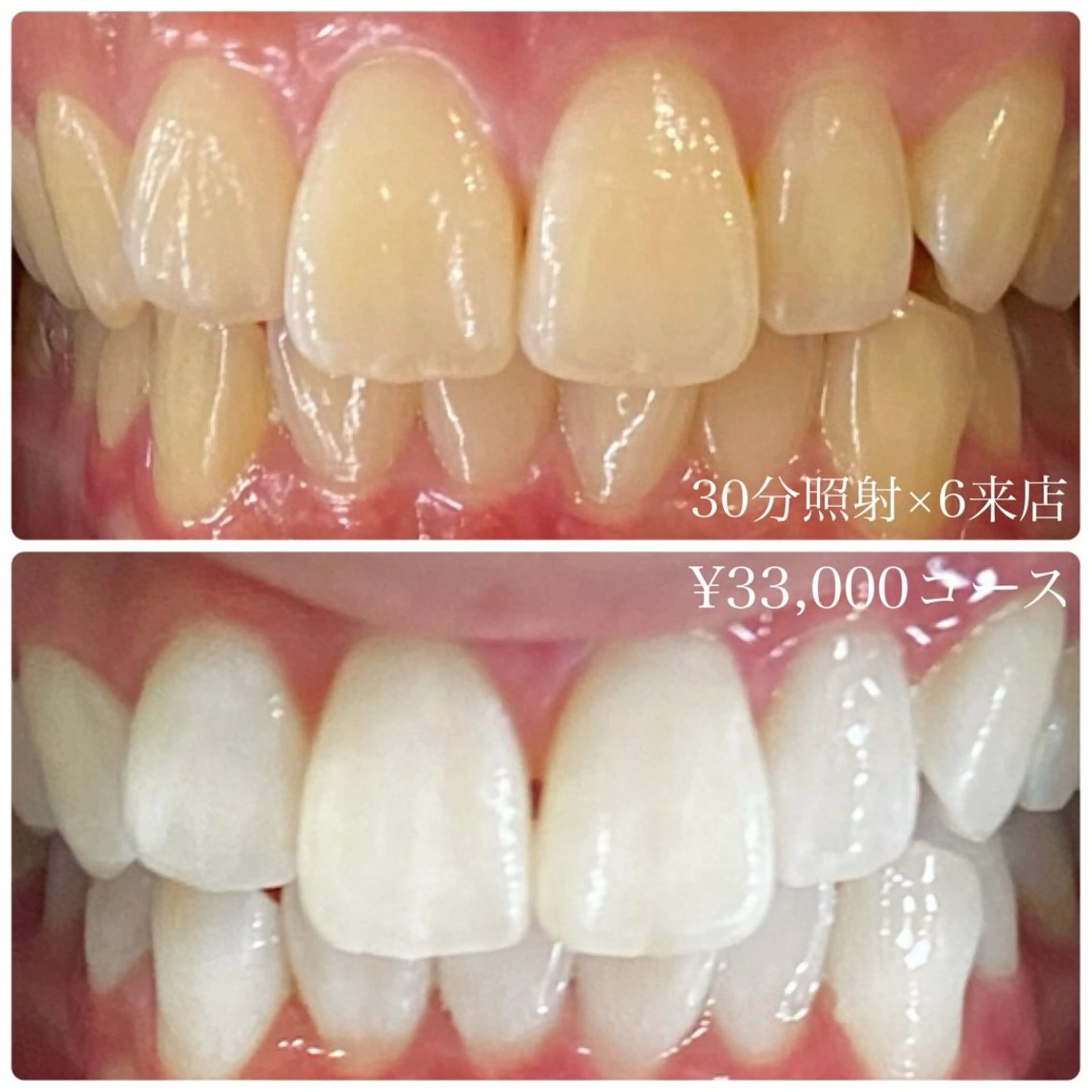 その他 PLATINUM Beauty 横浜店所属・ホワイトニングルーム 横浜店のその他イメージ