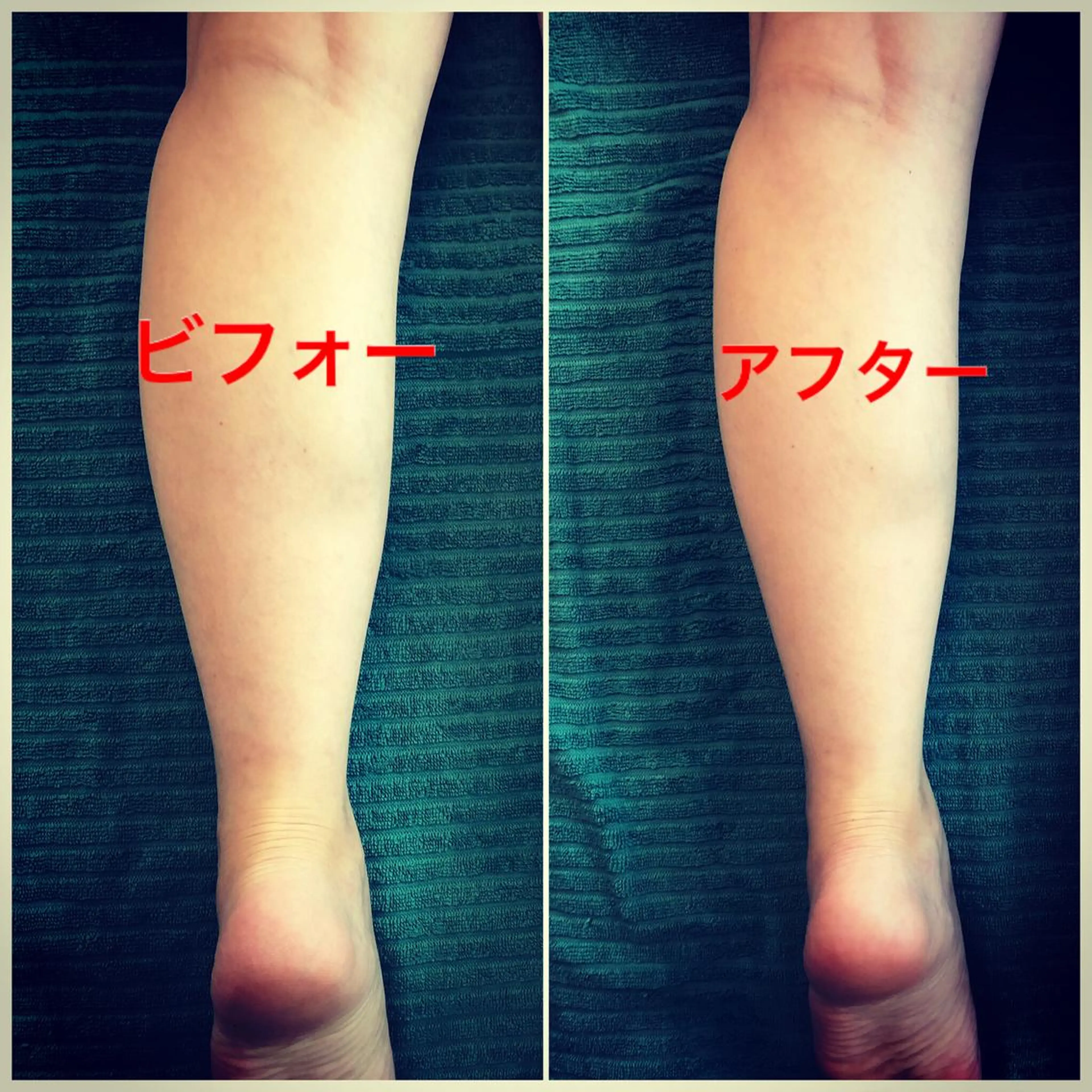 エステ リラク おうちサロン B-ROOMのエステ・リラクイメージ