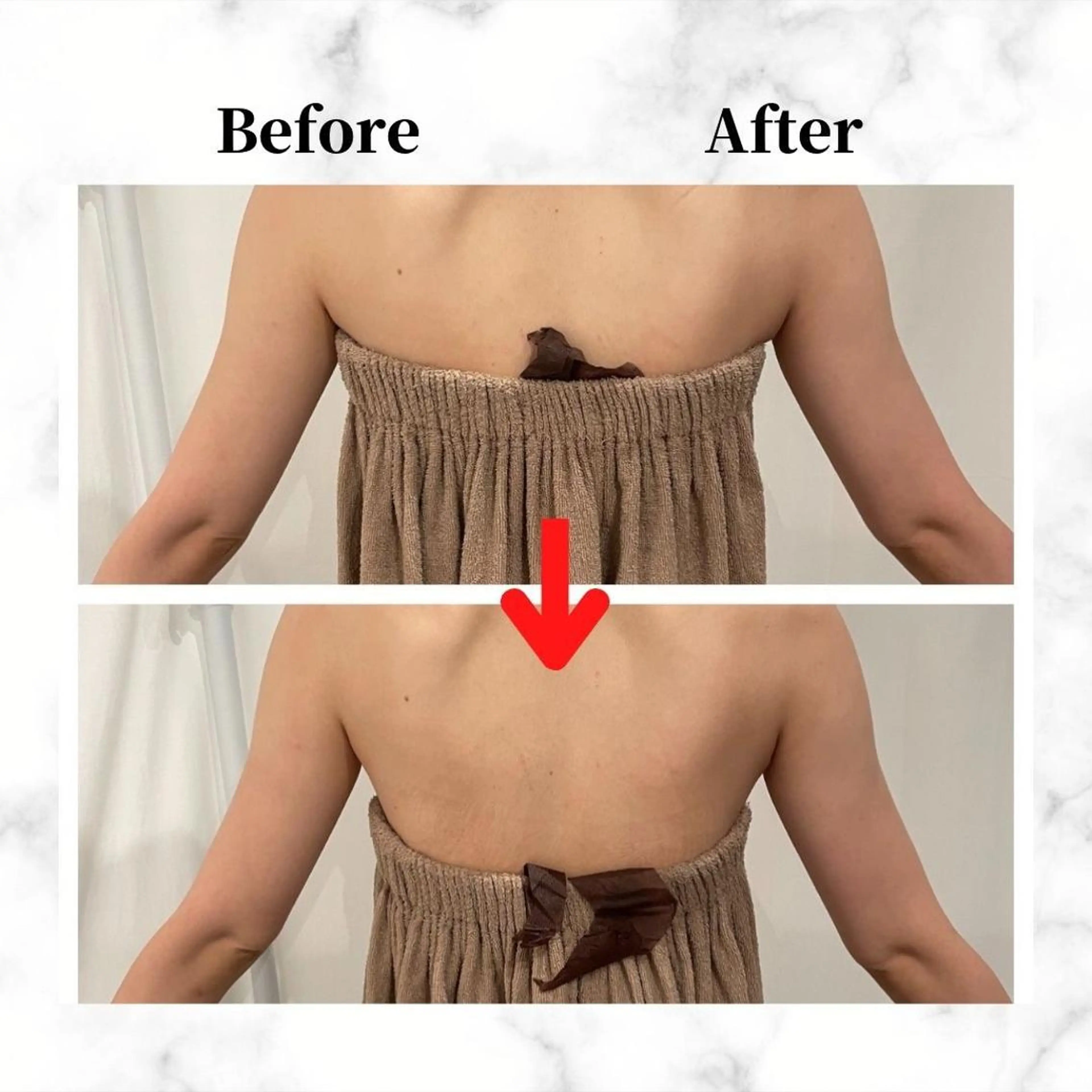 12Dハイフ💗 最強小顔のエステ・リラクイメージ