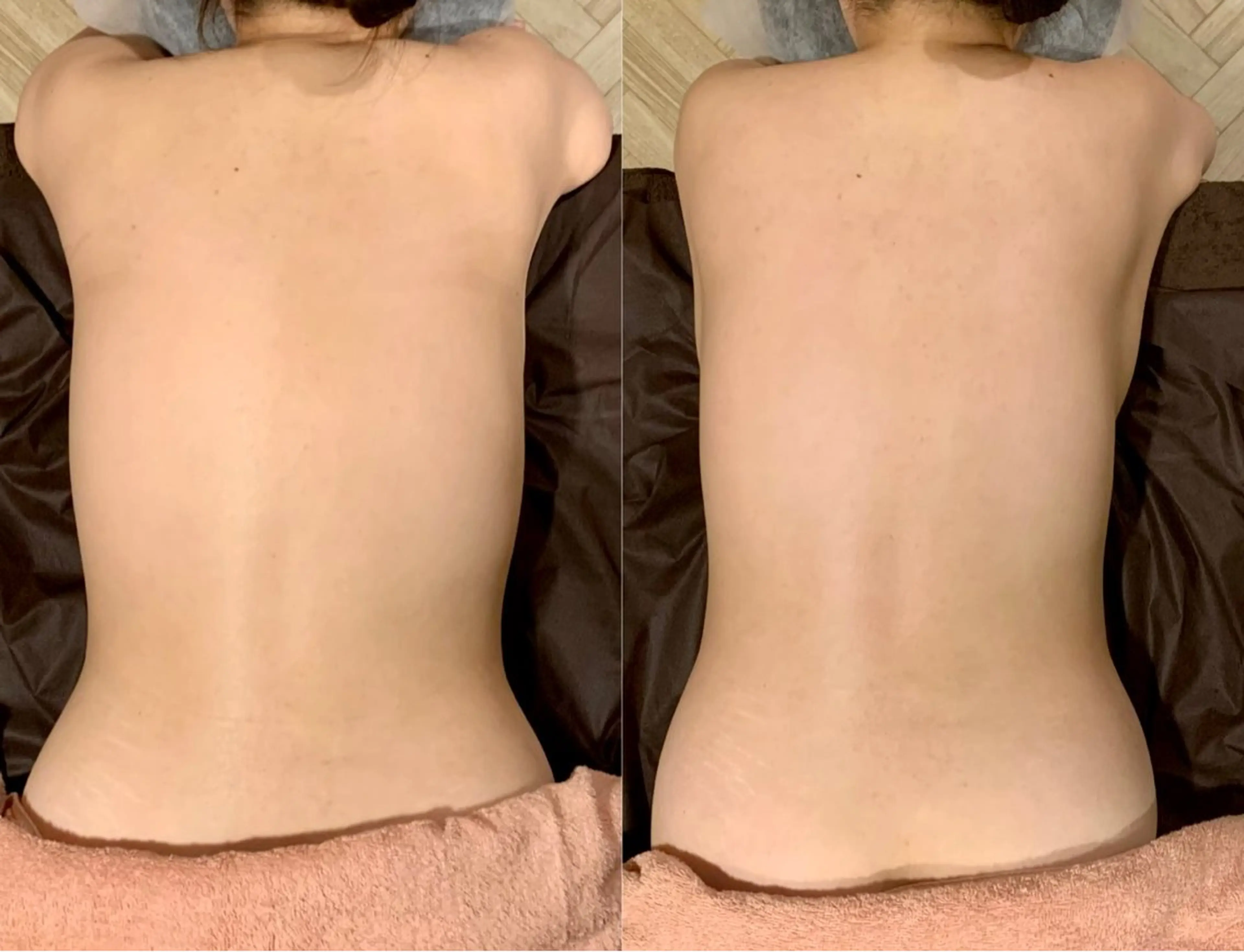 エステ リラク Rewhite -リホワイト-のエステ・リラクイメージ