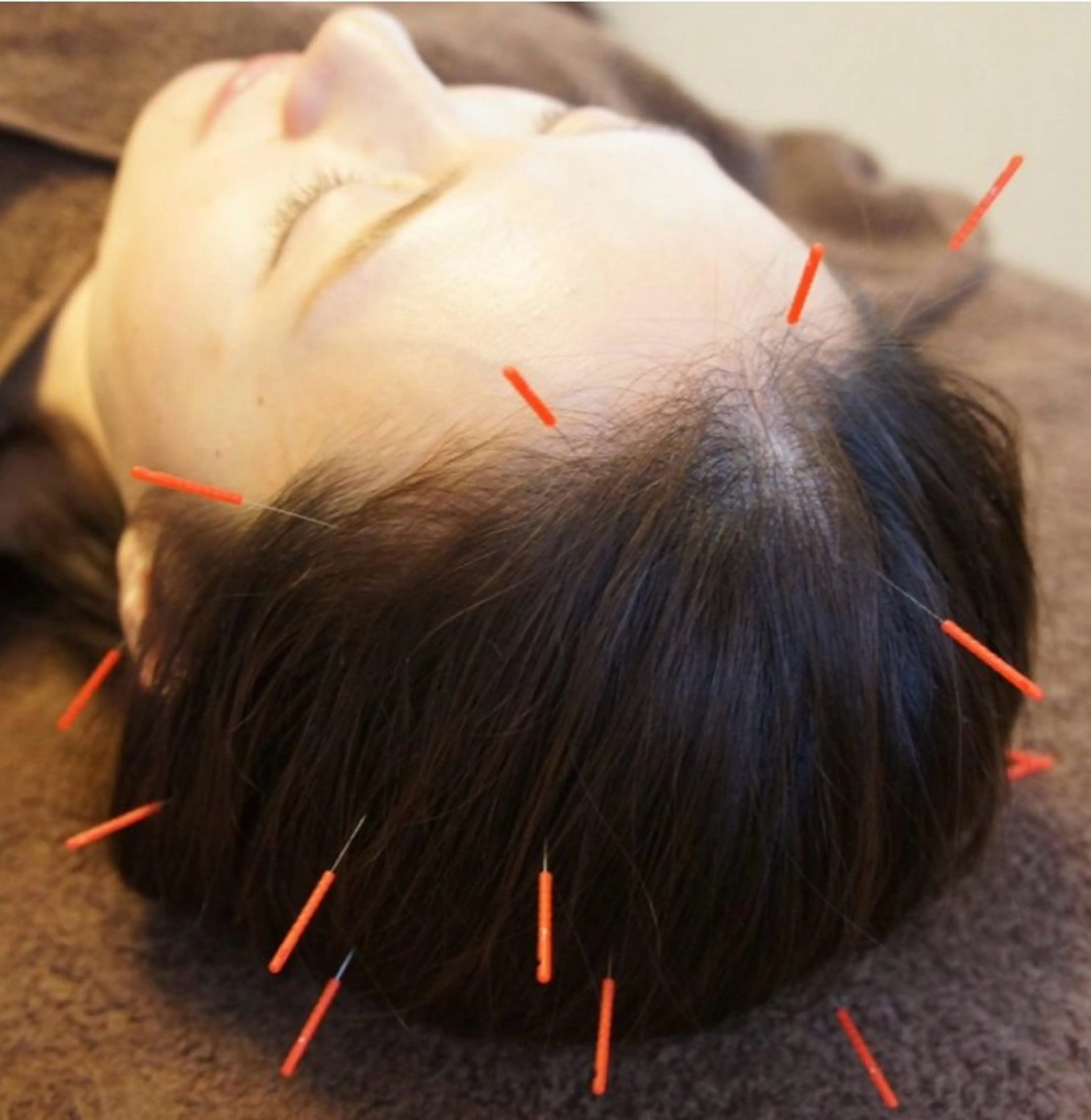 小林整骨院本町 美容鍼roomのエステ・リラクイメージ