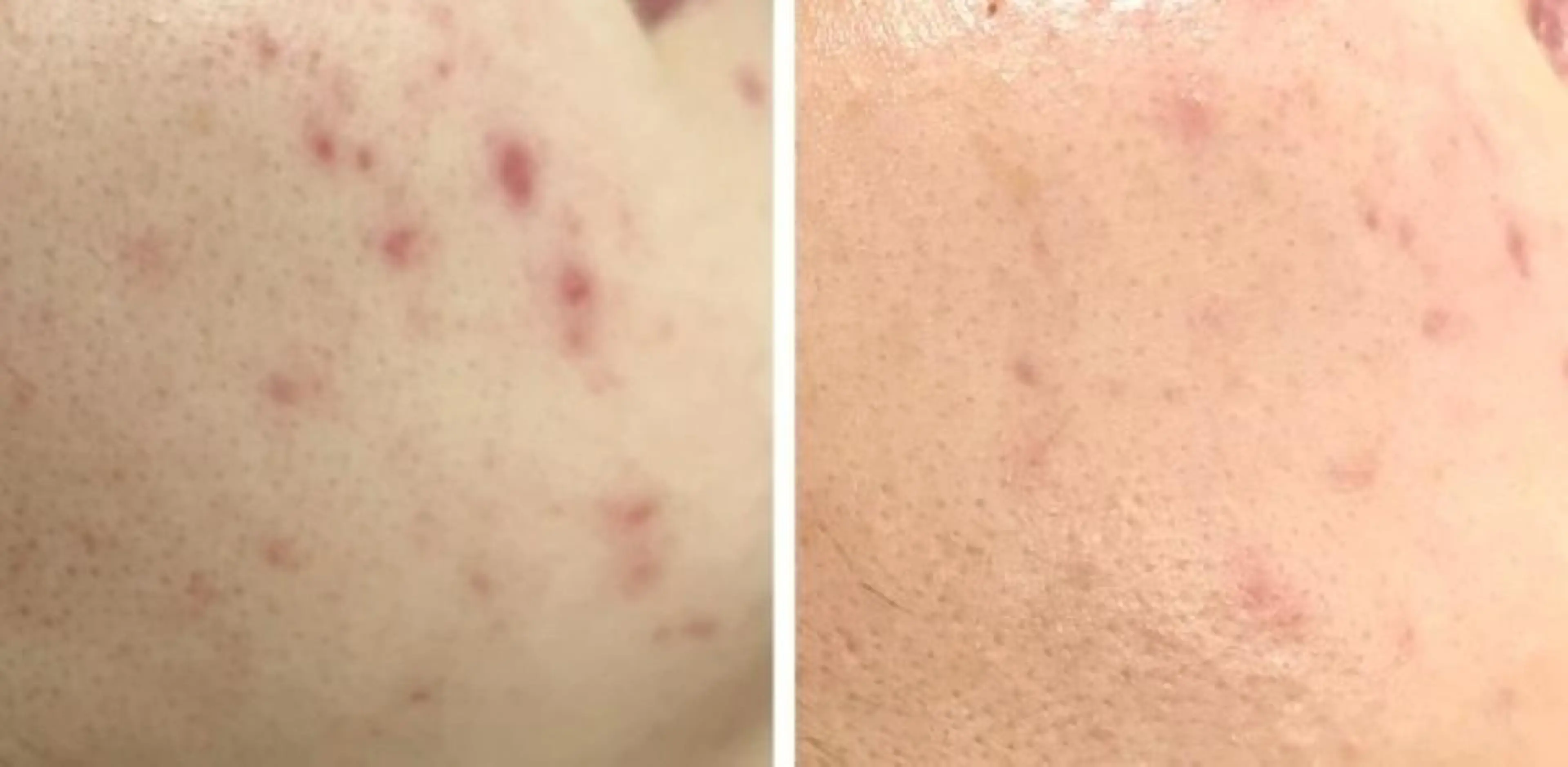 エステ 角栓取り専門エステ ベテラン講師幸田のエステ・リラクイメージ