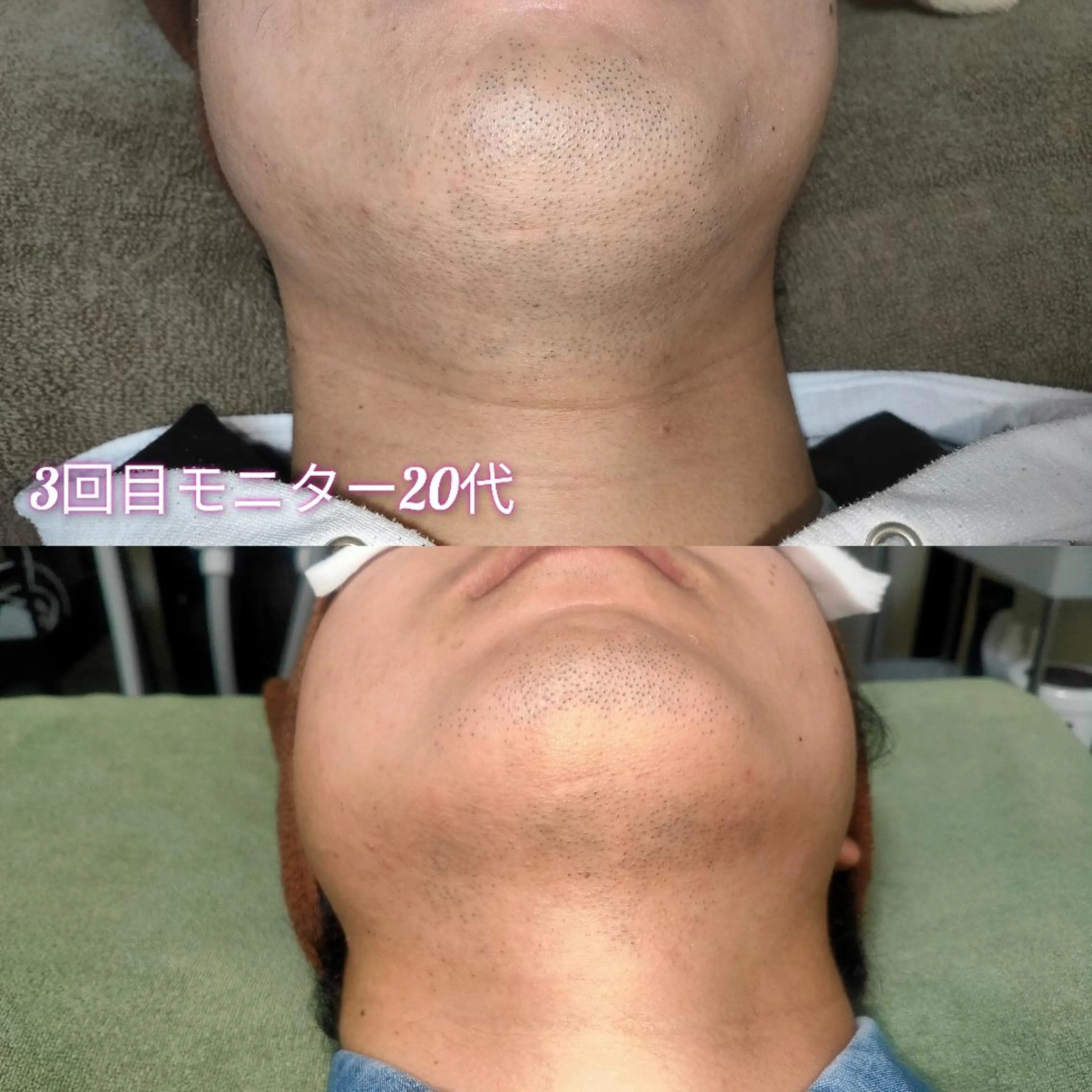 メンズ 脱毛 武 藤のエステ・リラクイメージ