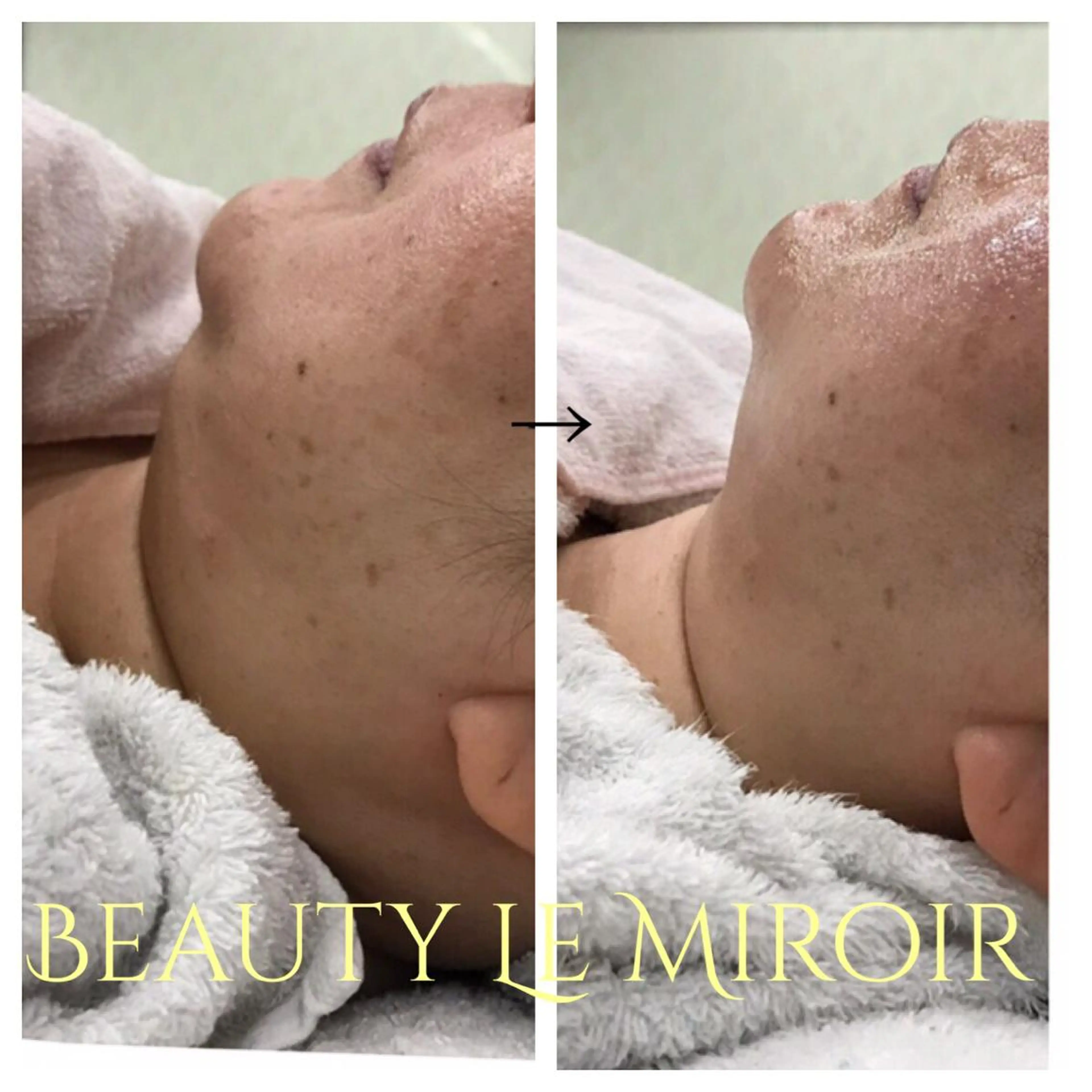 ビューティー ミロワールのエステ・リラクイメージ