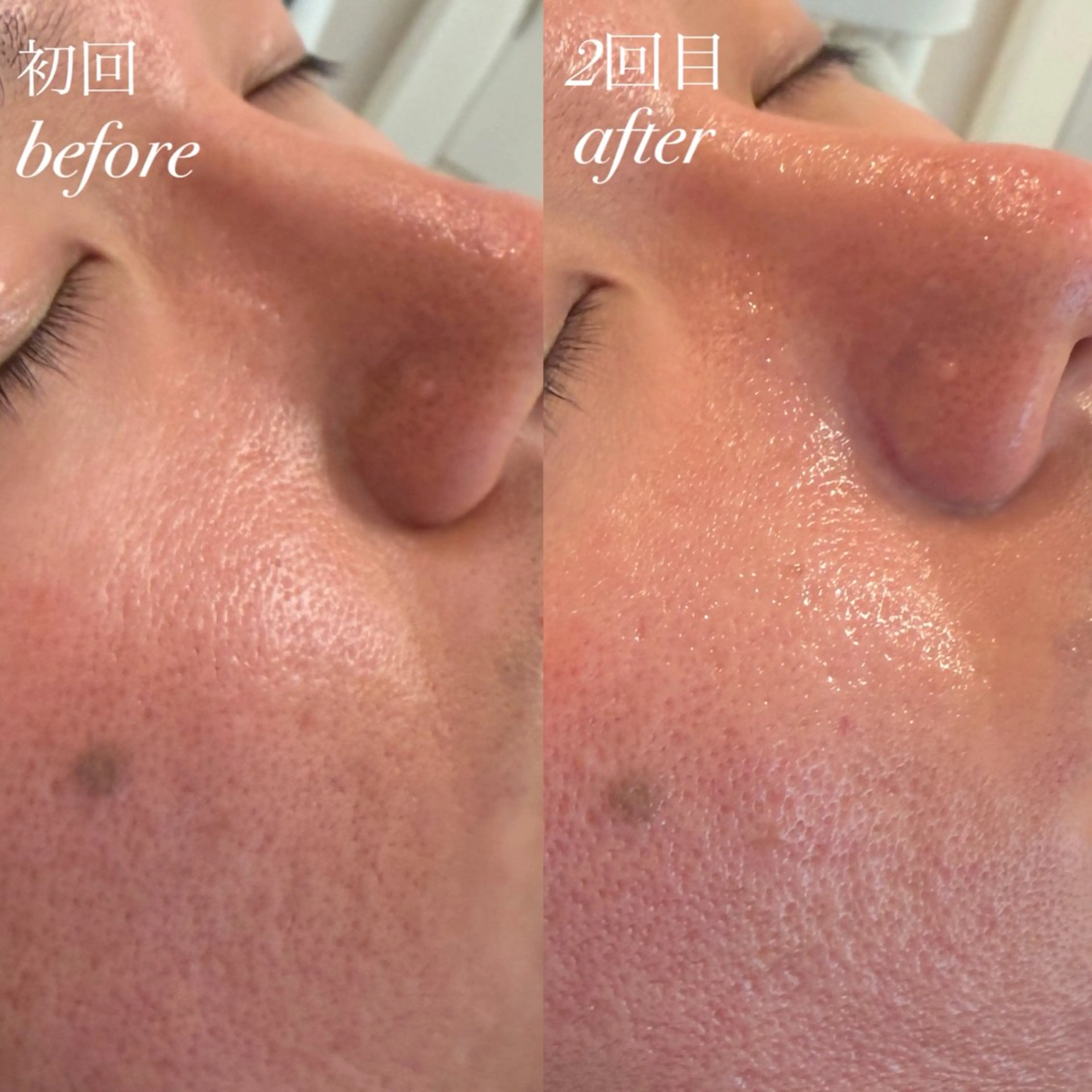 エステ 美養サロンハレハダ／ kanakoのエステ・リラクイメージ