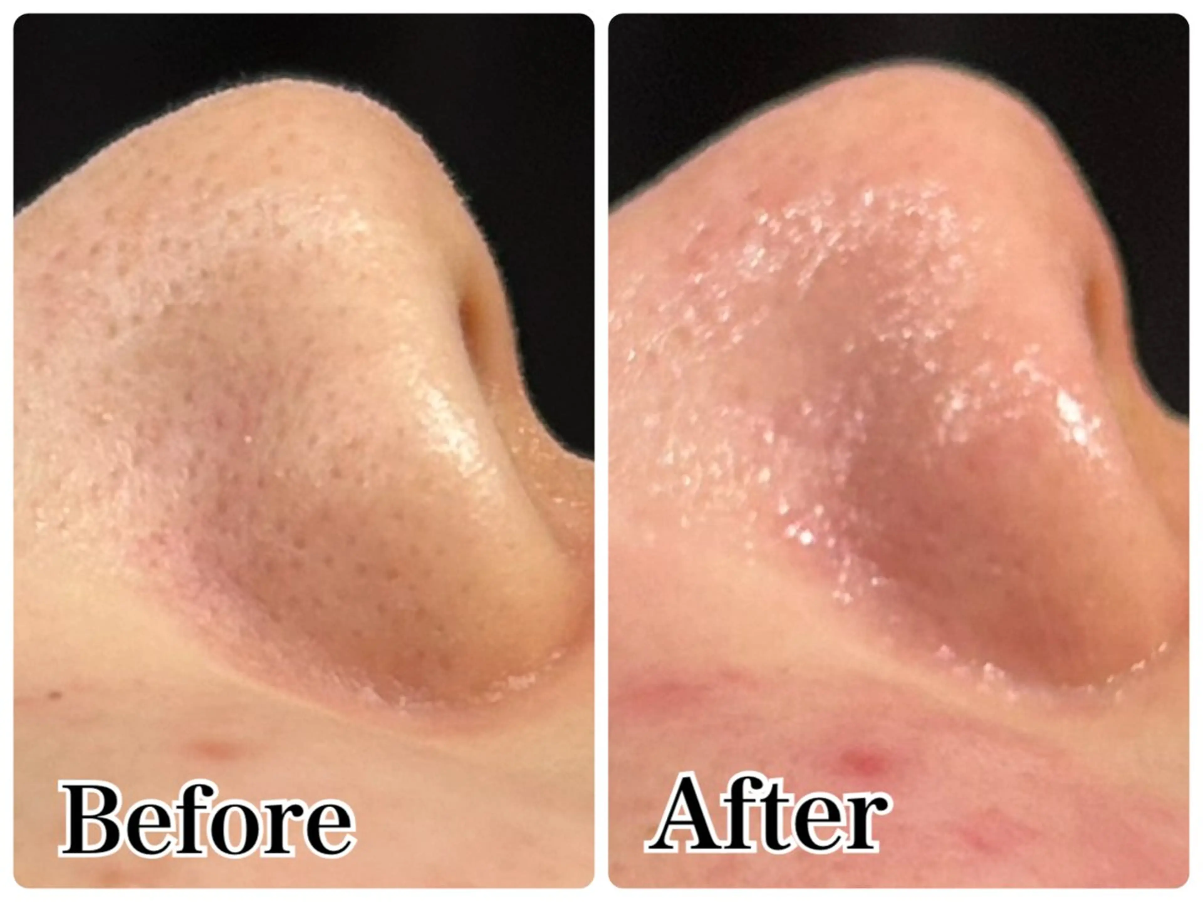 エステ Gemini MIKIのエステ・リラクイメージ