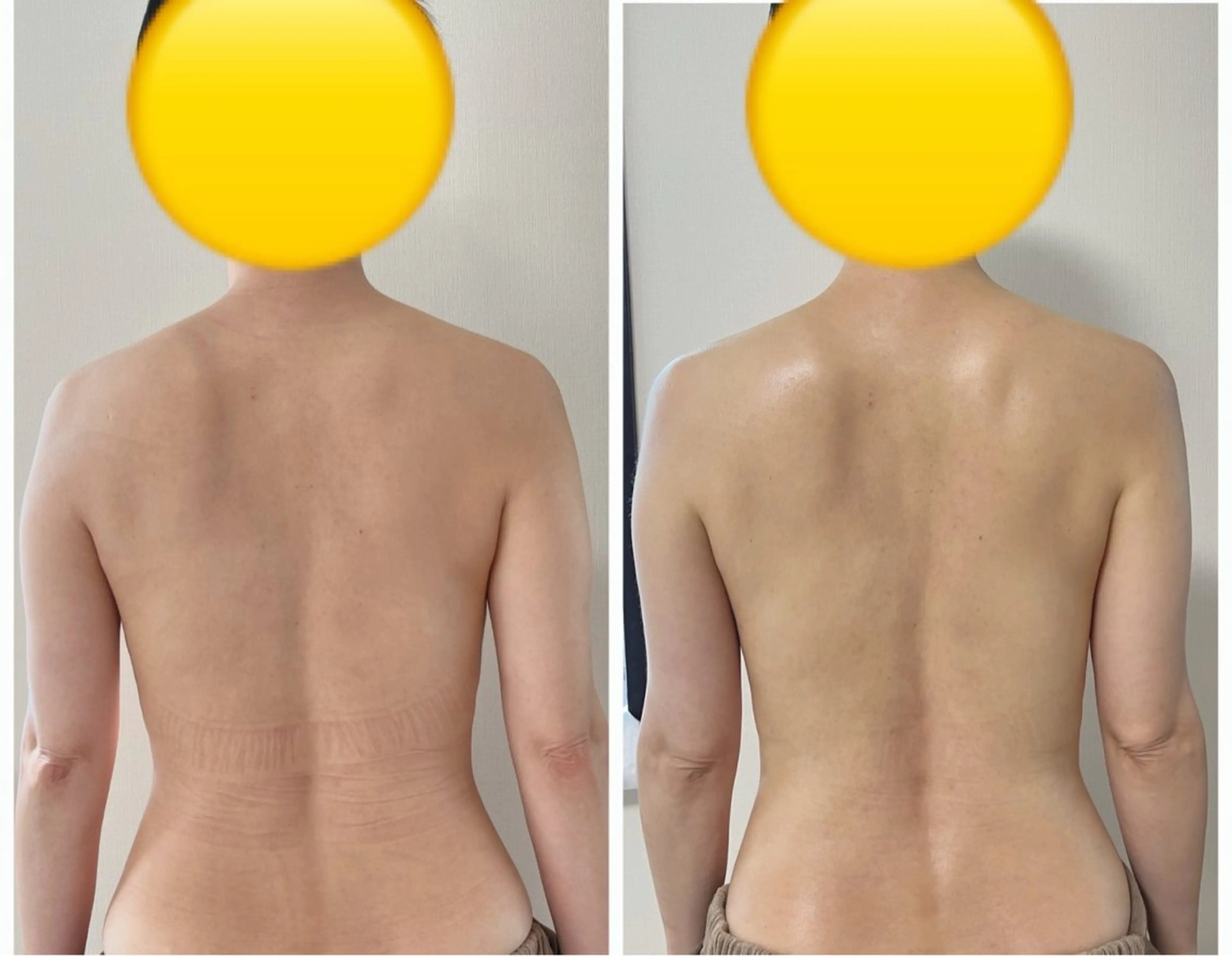 【肩コリ背中コリ・細っそり二の腕】マッサージと燃焼マシンの60分コース！の写真