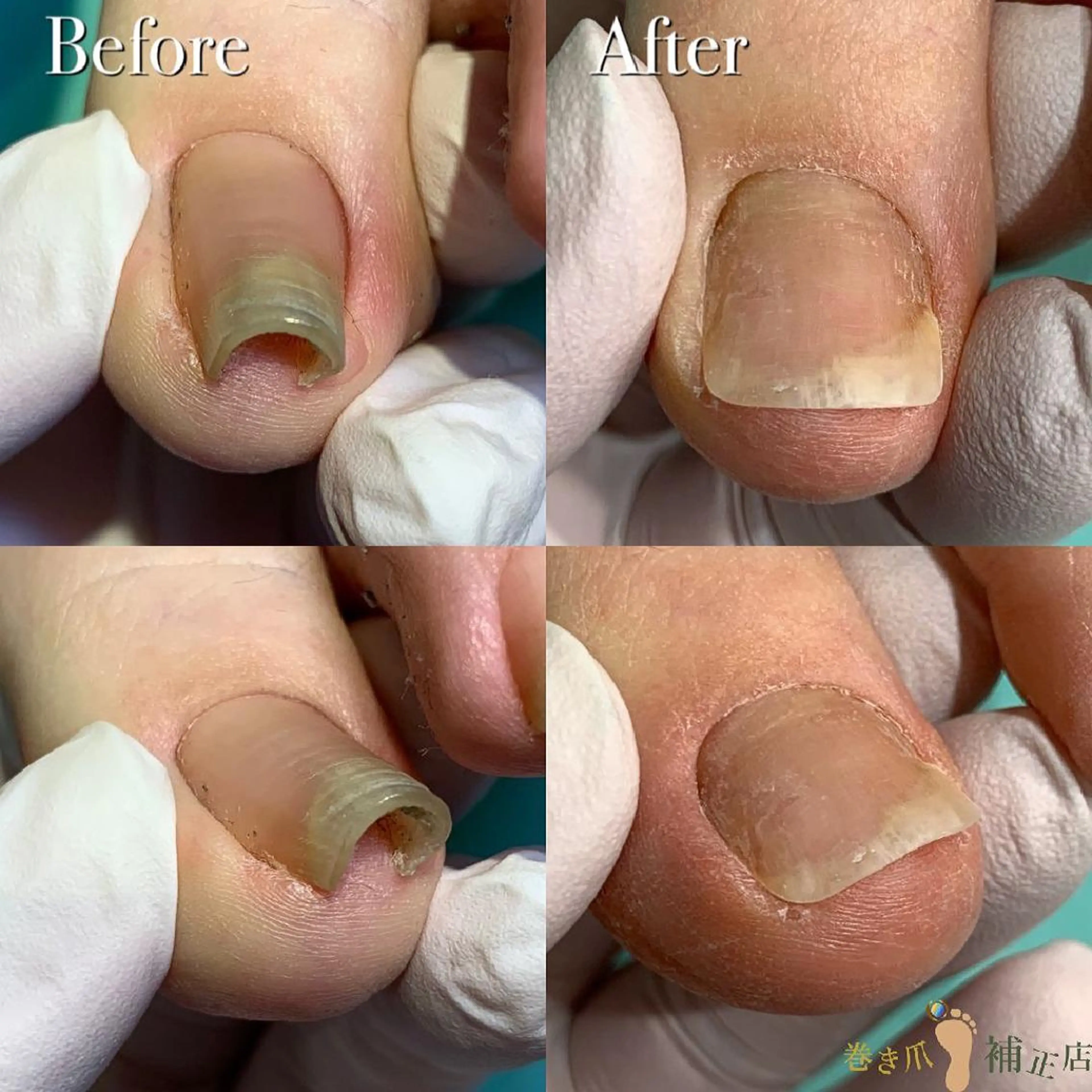 ネイル 東京巻き爪アカデミー所属・東京巻き爪 アカデミーのエステ・リラクイメージ