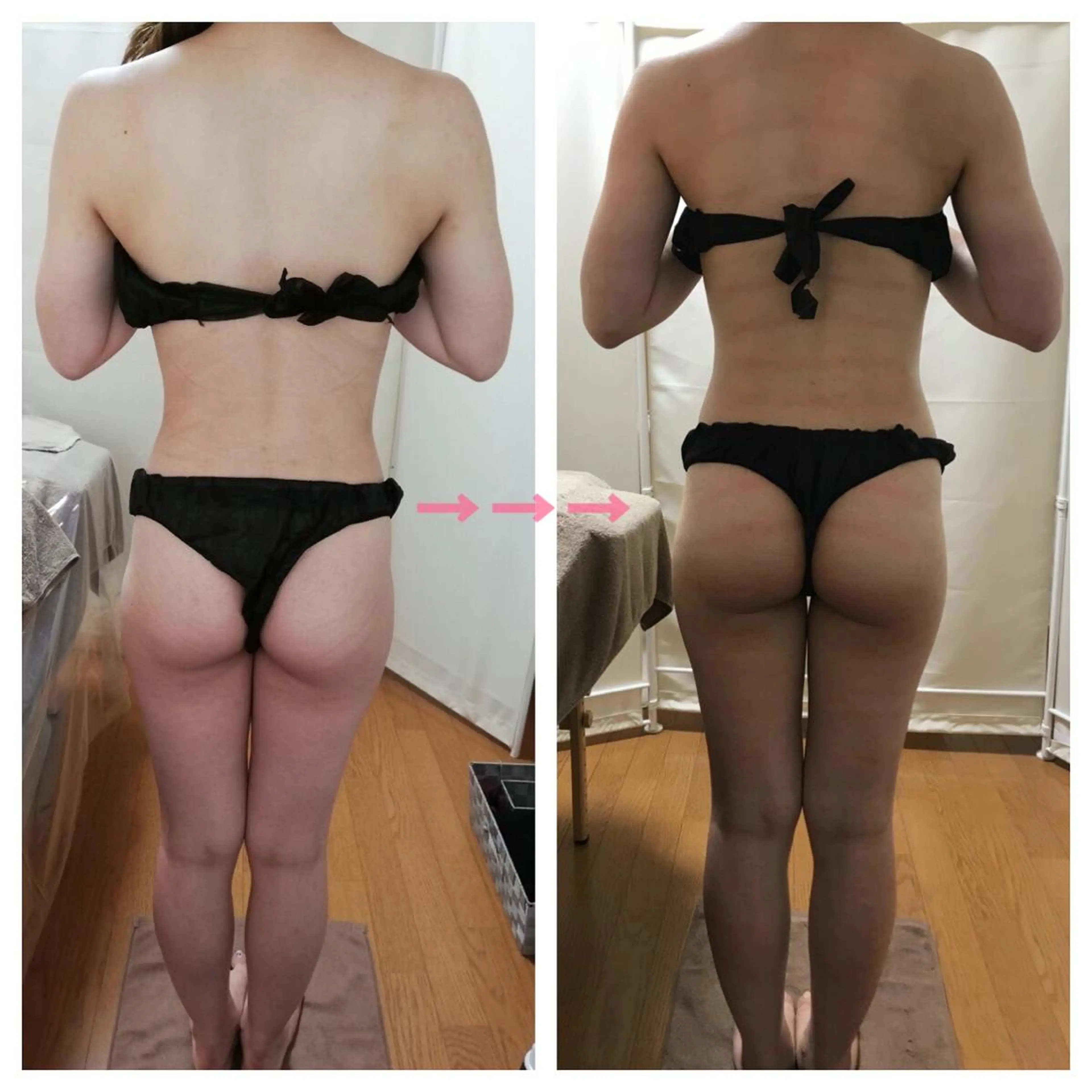 biloop所属・《本気痩せ×疲労改善 》  BILOOPのエステ・リラクイメージ