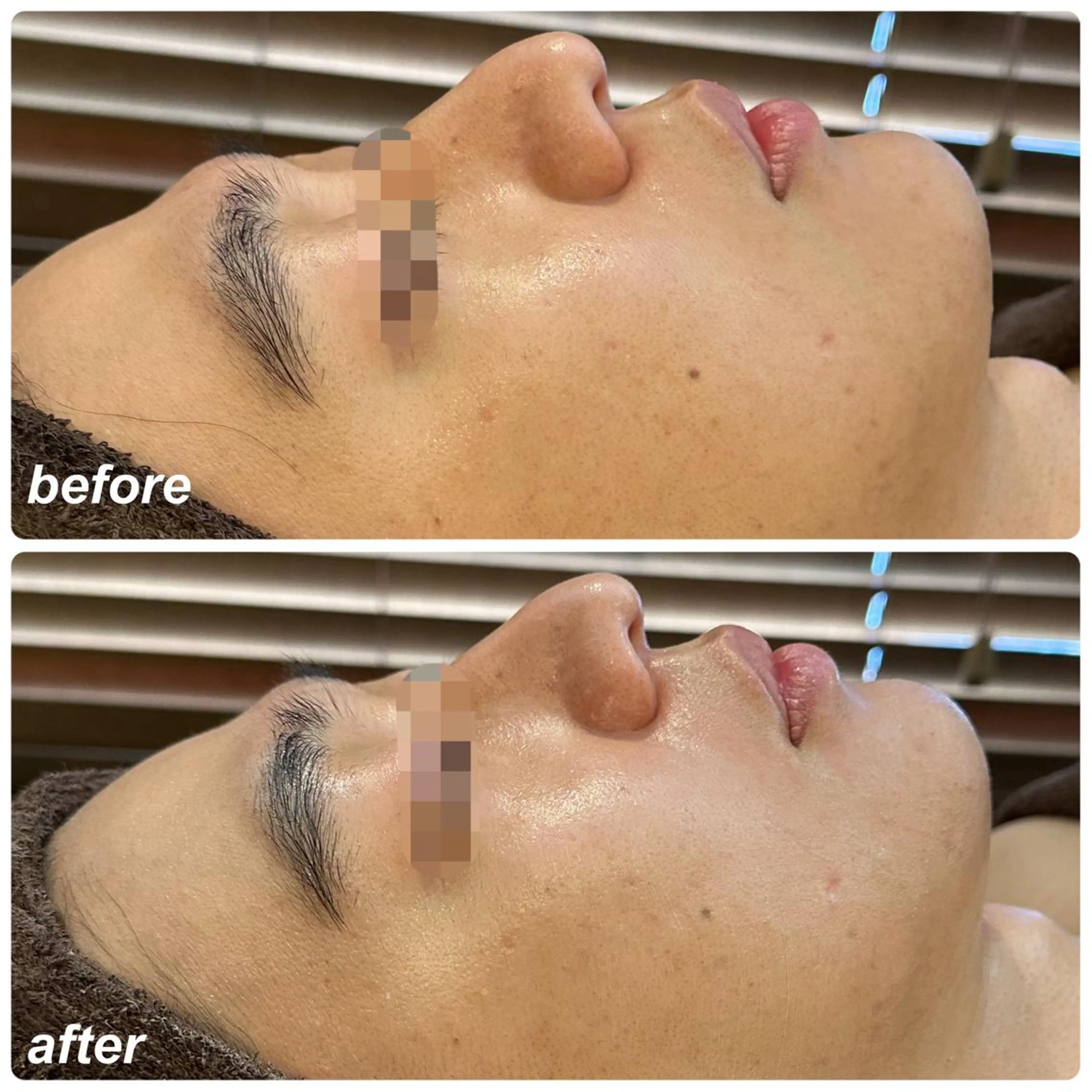 メンズ エステ LILY Eのエステ・リラクイメージ