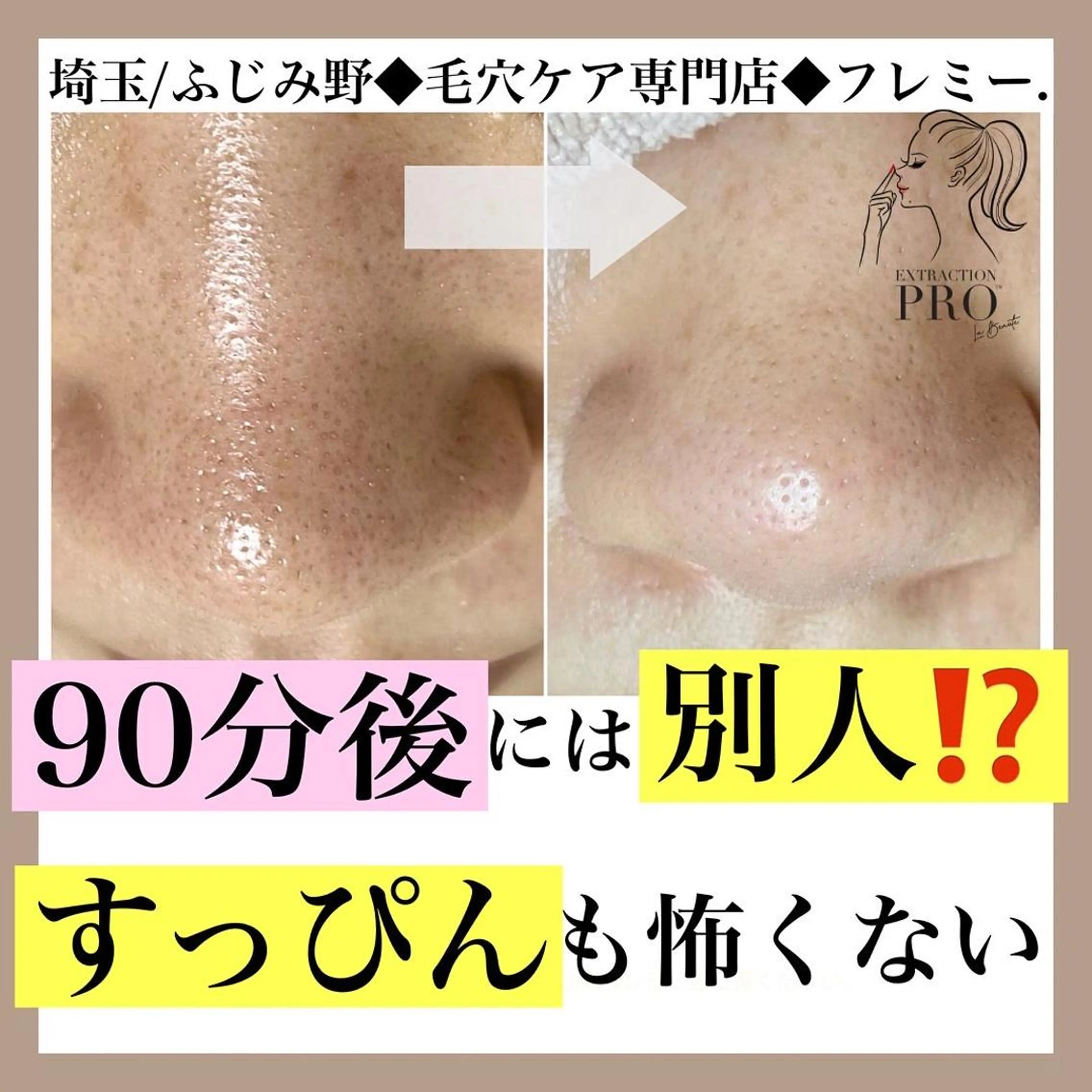 本気の毛穴改善Aコース(デコルテ&ヘッドマッサージ付)※毛穴エクストラクションプロの写真