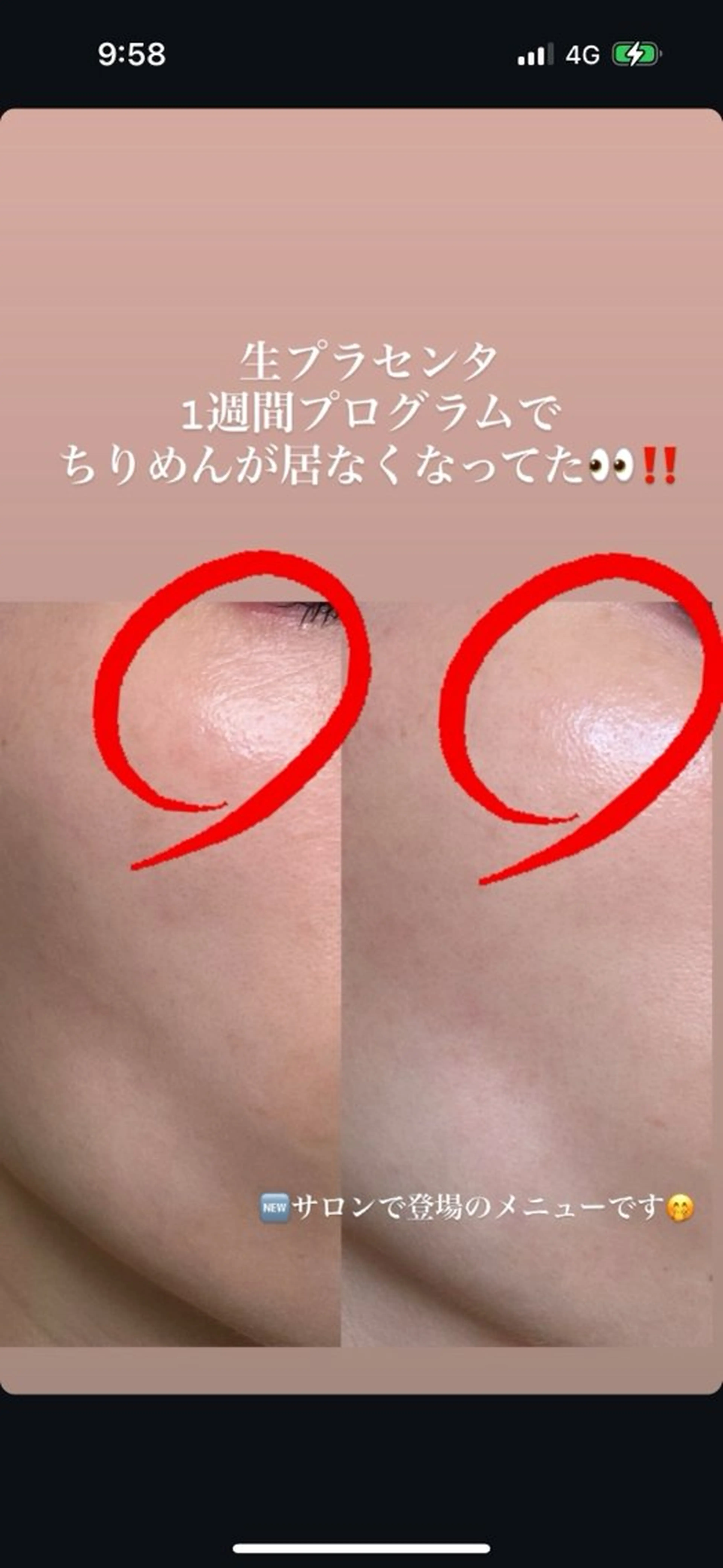 女性専用ボディメイク Ma-Na【マーナ】のエステ・リラクイメージ