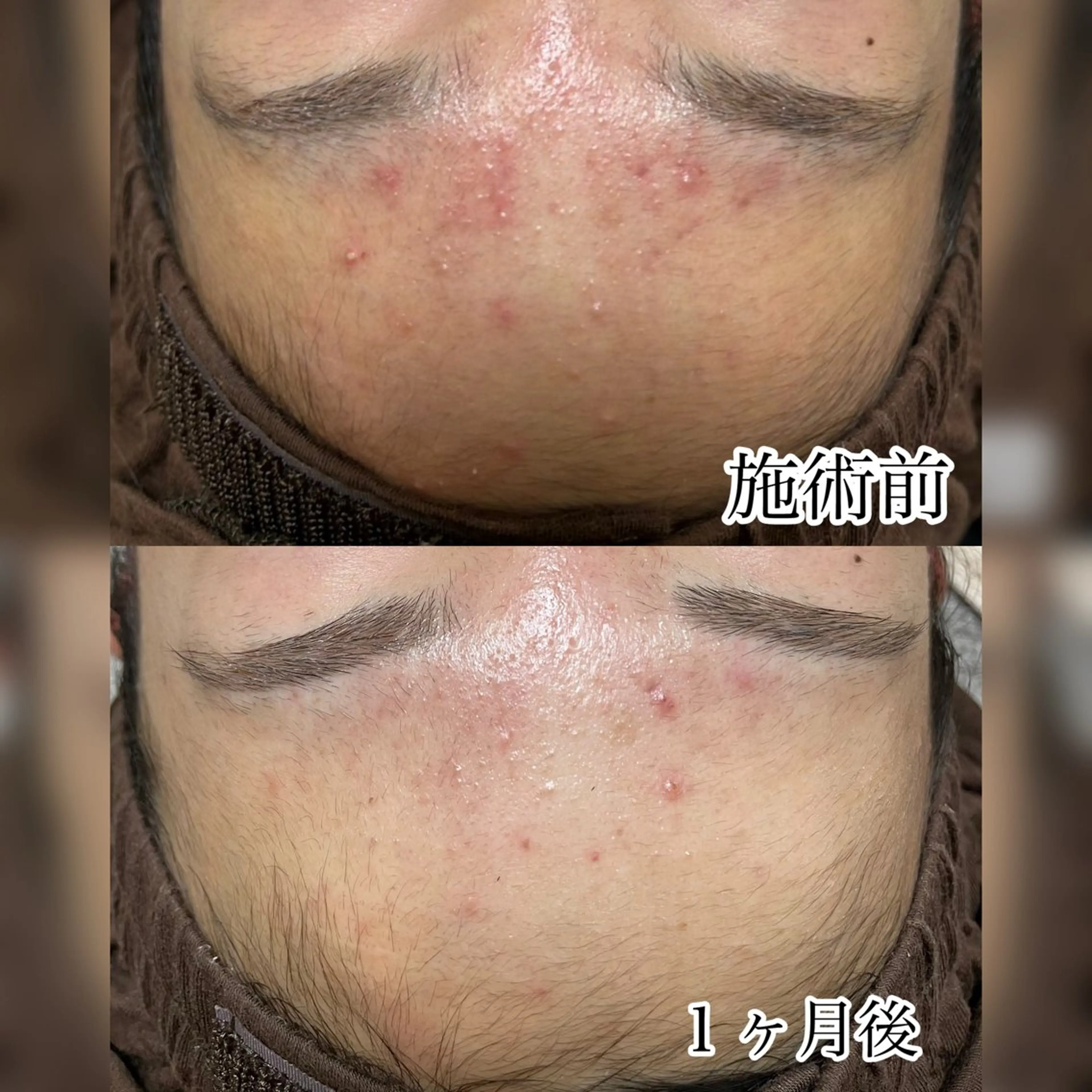 美肌ケアサロン halu（ハル）のエステ・リラクイメージ