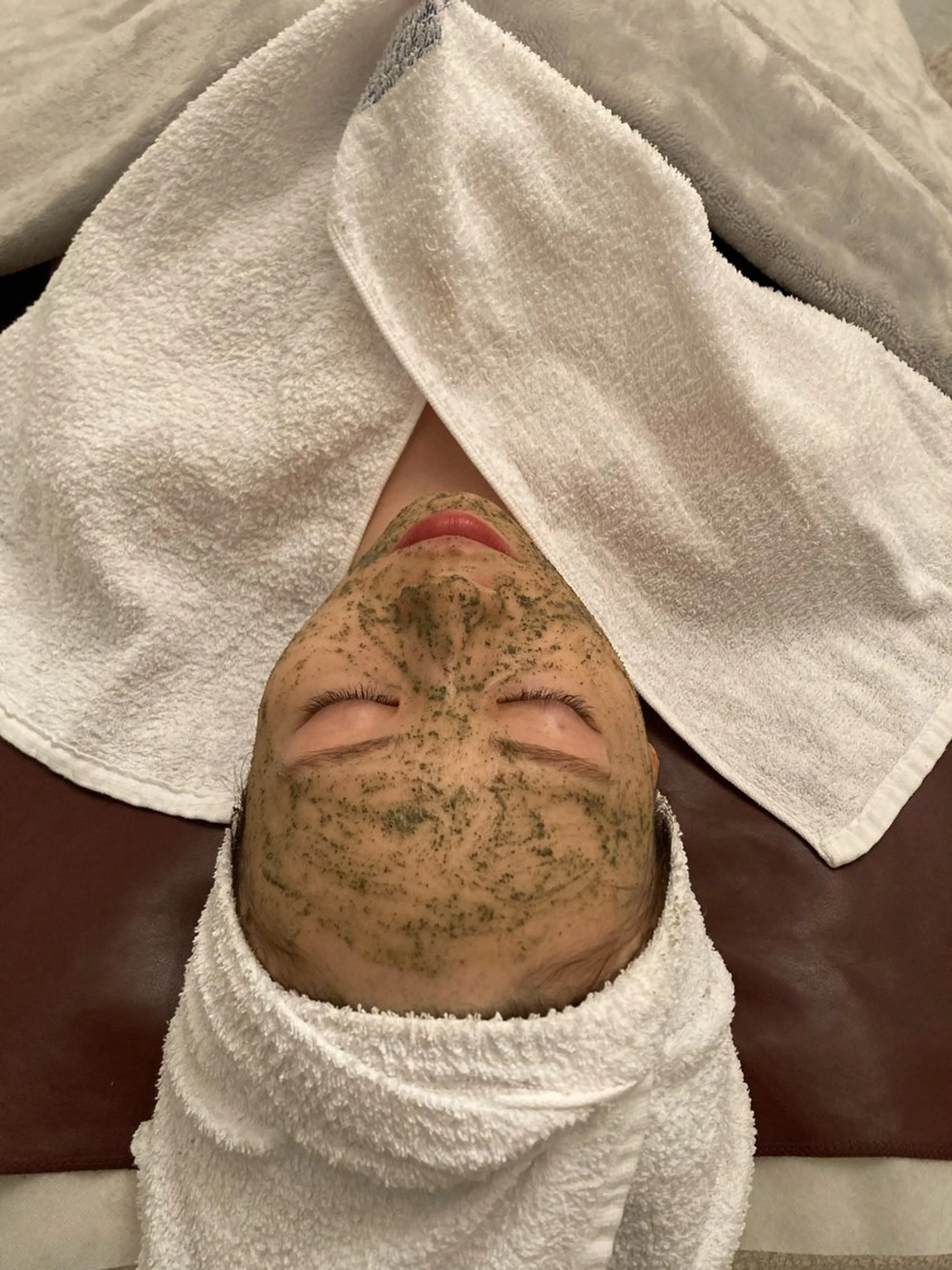 ニキビ肌/ シミシワのお悩みに植物ハーブピーリング🌿ターンオーバーと肌再生を促す美肌プランの写真