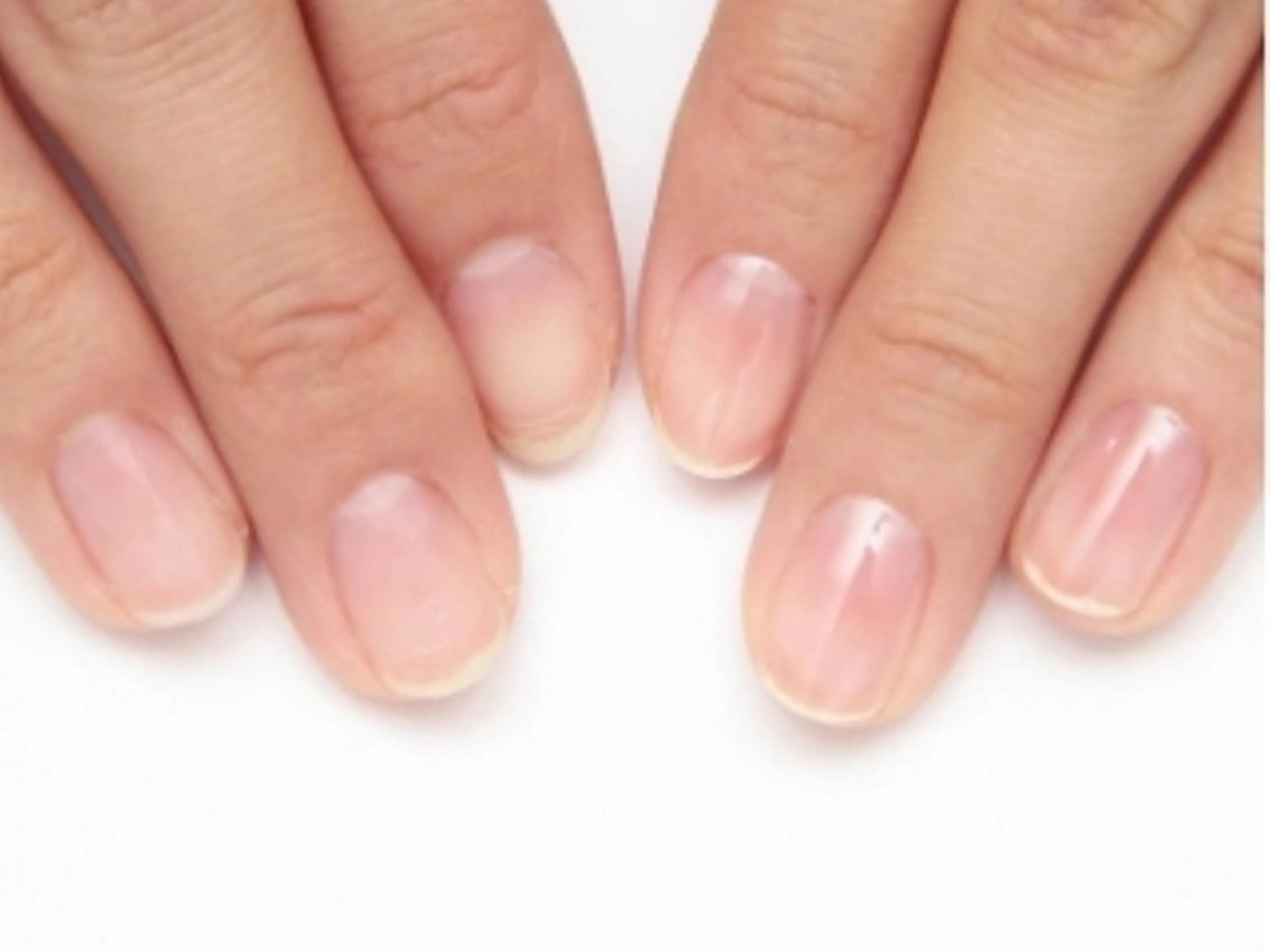 【Hand】自爪ネイルケア＋保湿ケアの写真