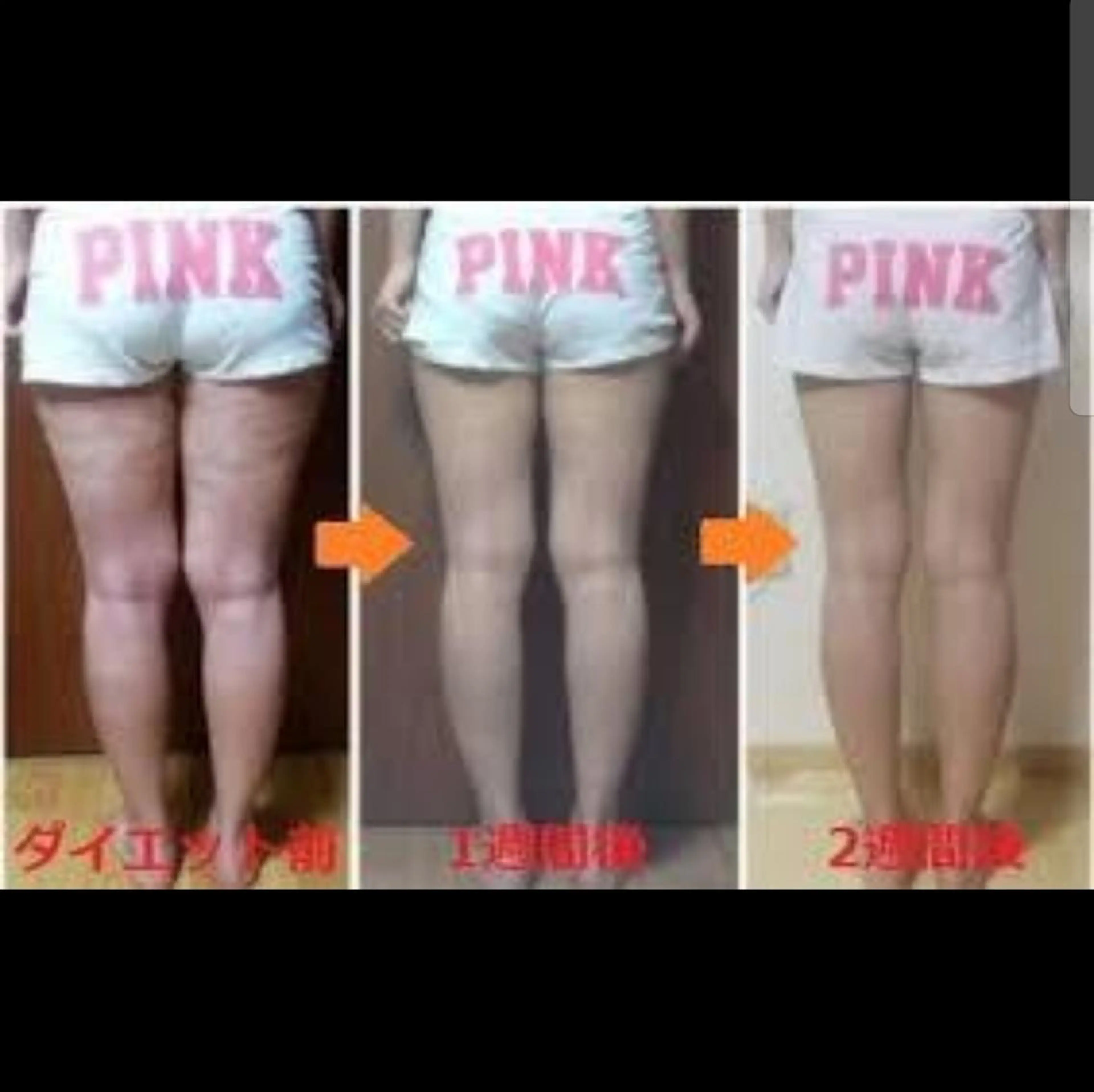 脚全体 裏 表 (太腿 とふくらはぎ)のダイエット リピーターは12000円。お得な5回コース50000円になります。の写真