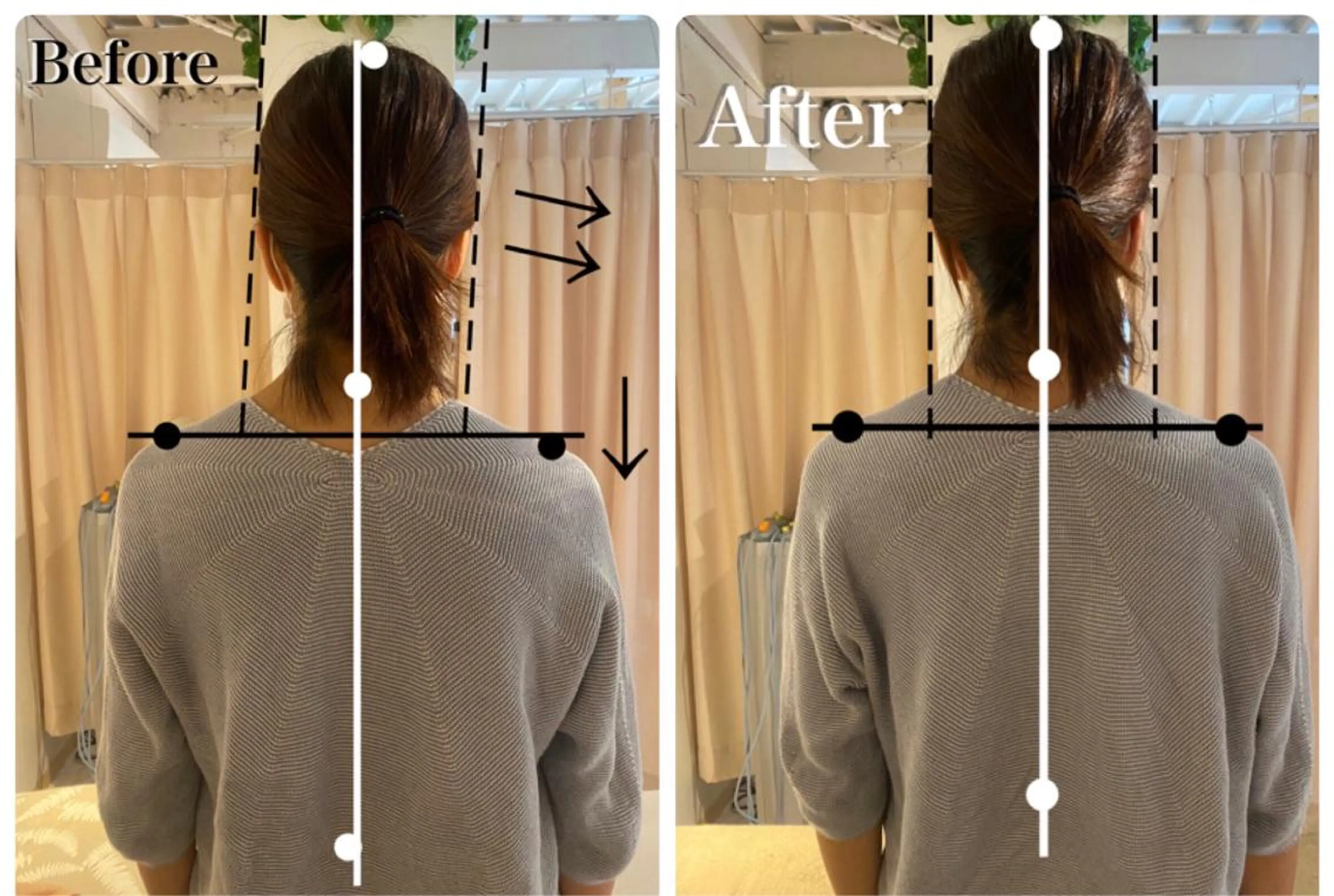 鍼灸 Refineのその他イメージ