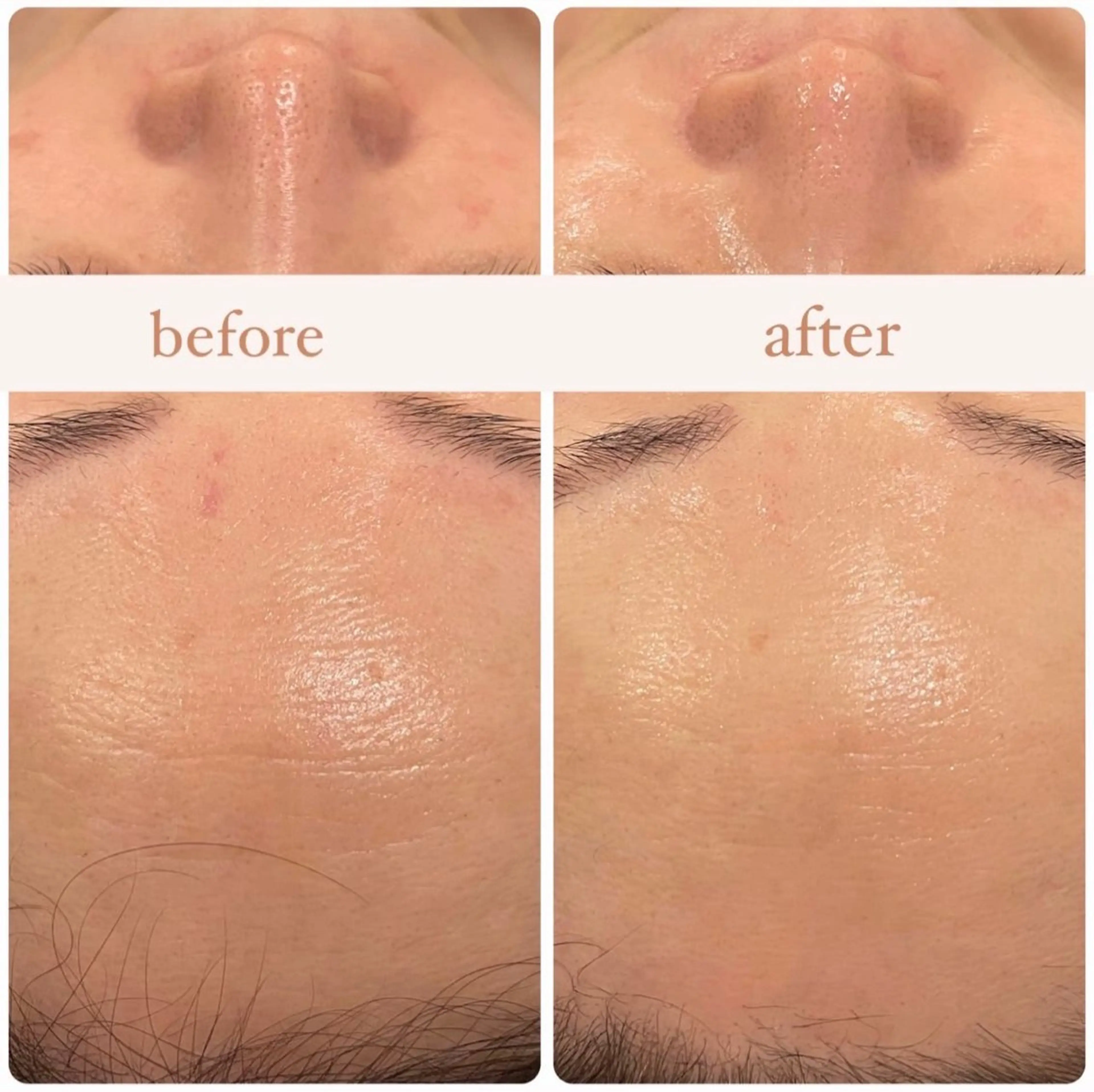 【美肌コルギ80分】憧れのすっぴん美人へ✨うるつやピーリングで美肌にの写真