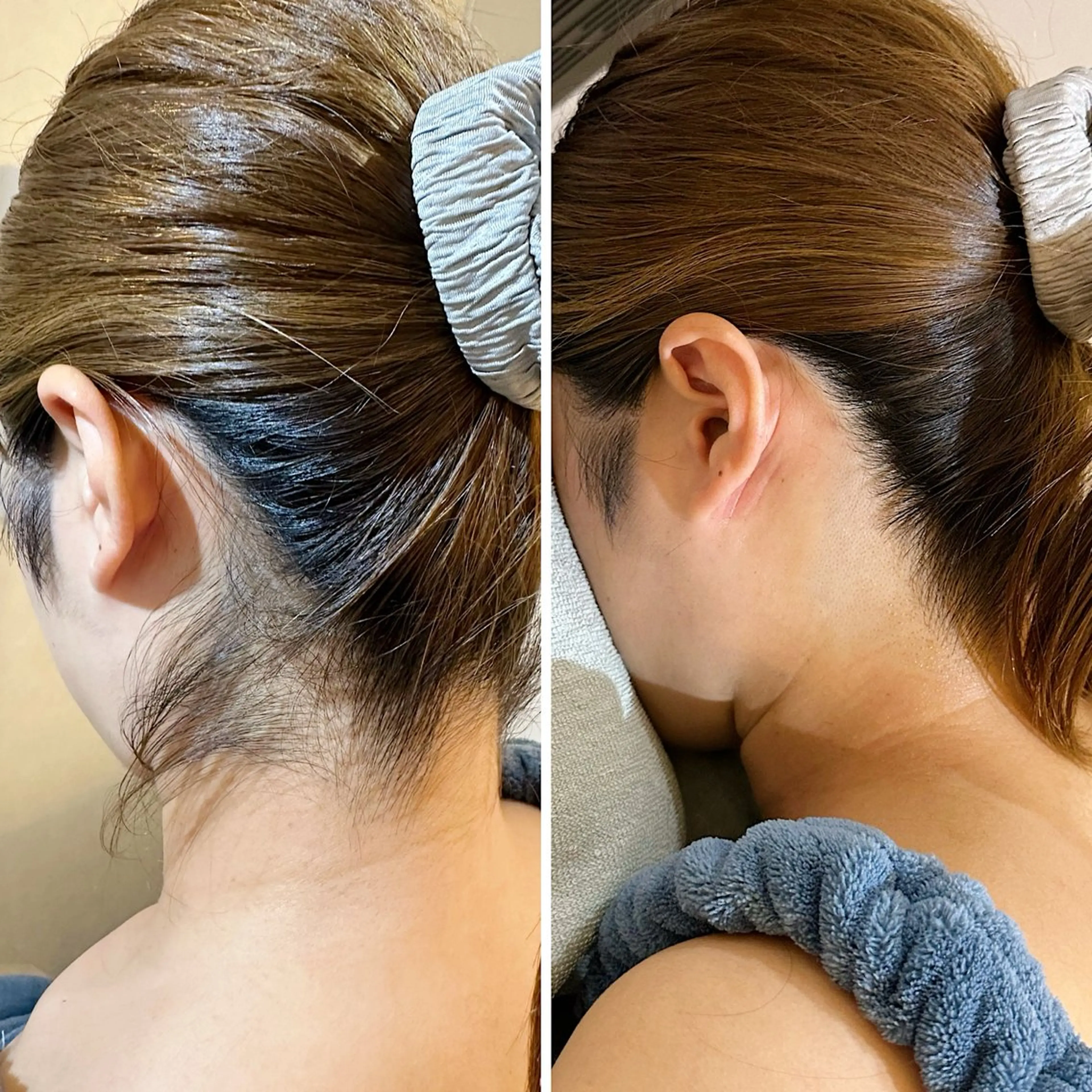 脱毛 うなじ脱毛/美肌脱毛 LABELのエステ・リラクイメージ