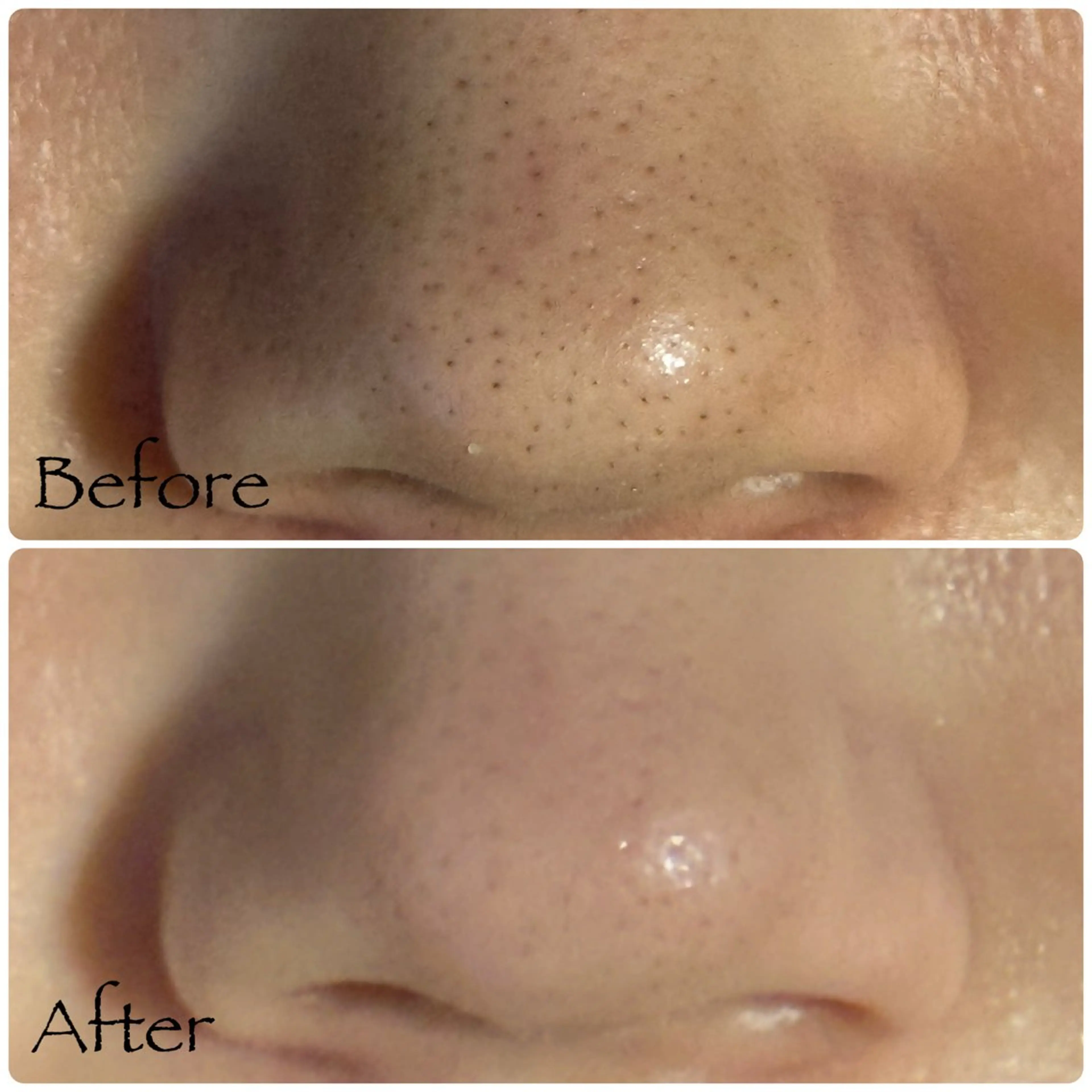 ソワン所属・脱毛 フェイシャル soin～ソワン～のエステ・リラクイメージ