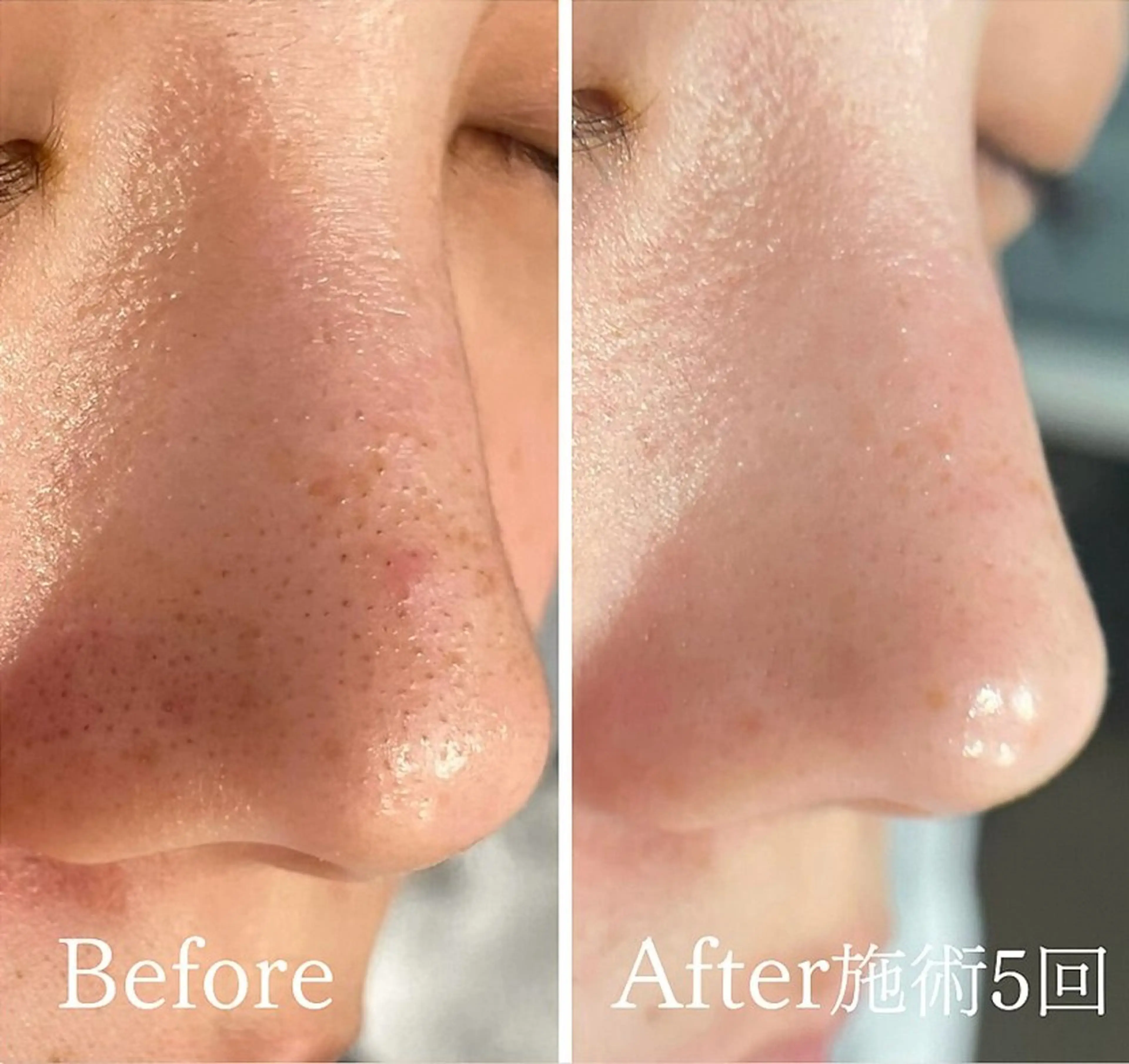 アンド ミルルのエステ・リラクイメージ