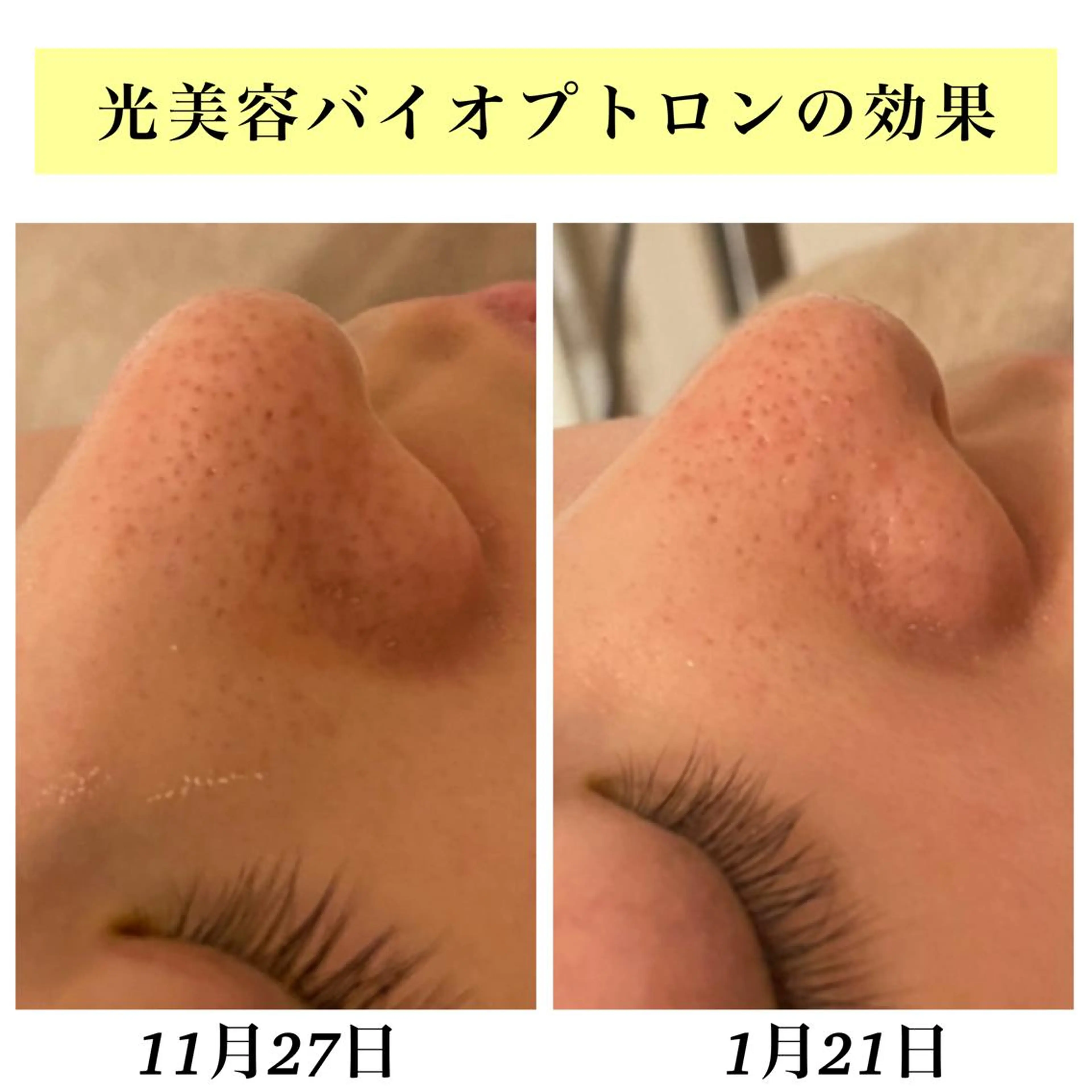 Bellesthe （ベルエステ）のエステ・リラクイメージ