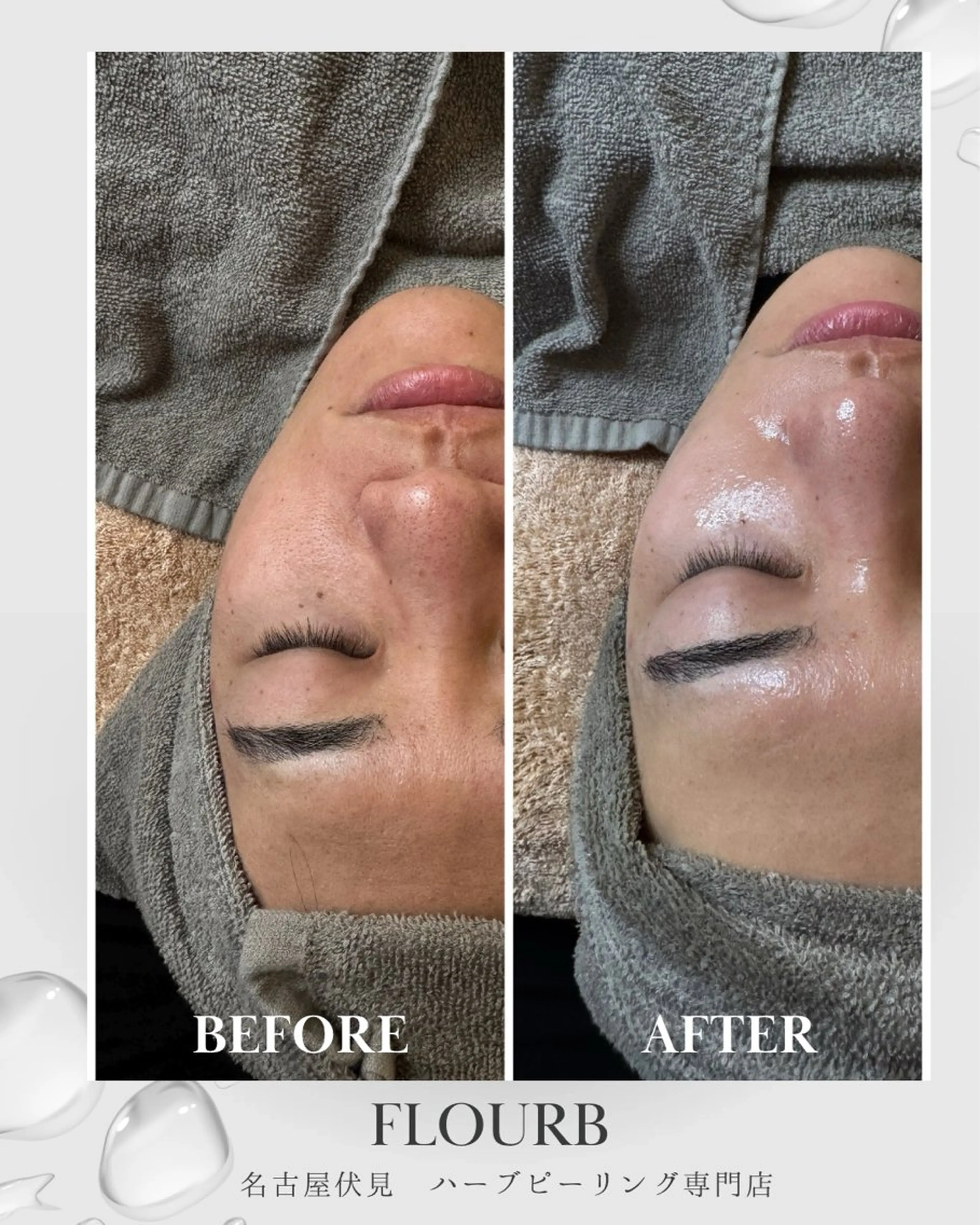 エステ ハーブピーリング専門 サロンFlourbのエステ・リラクイメージ