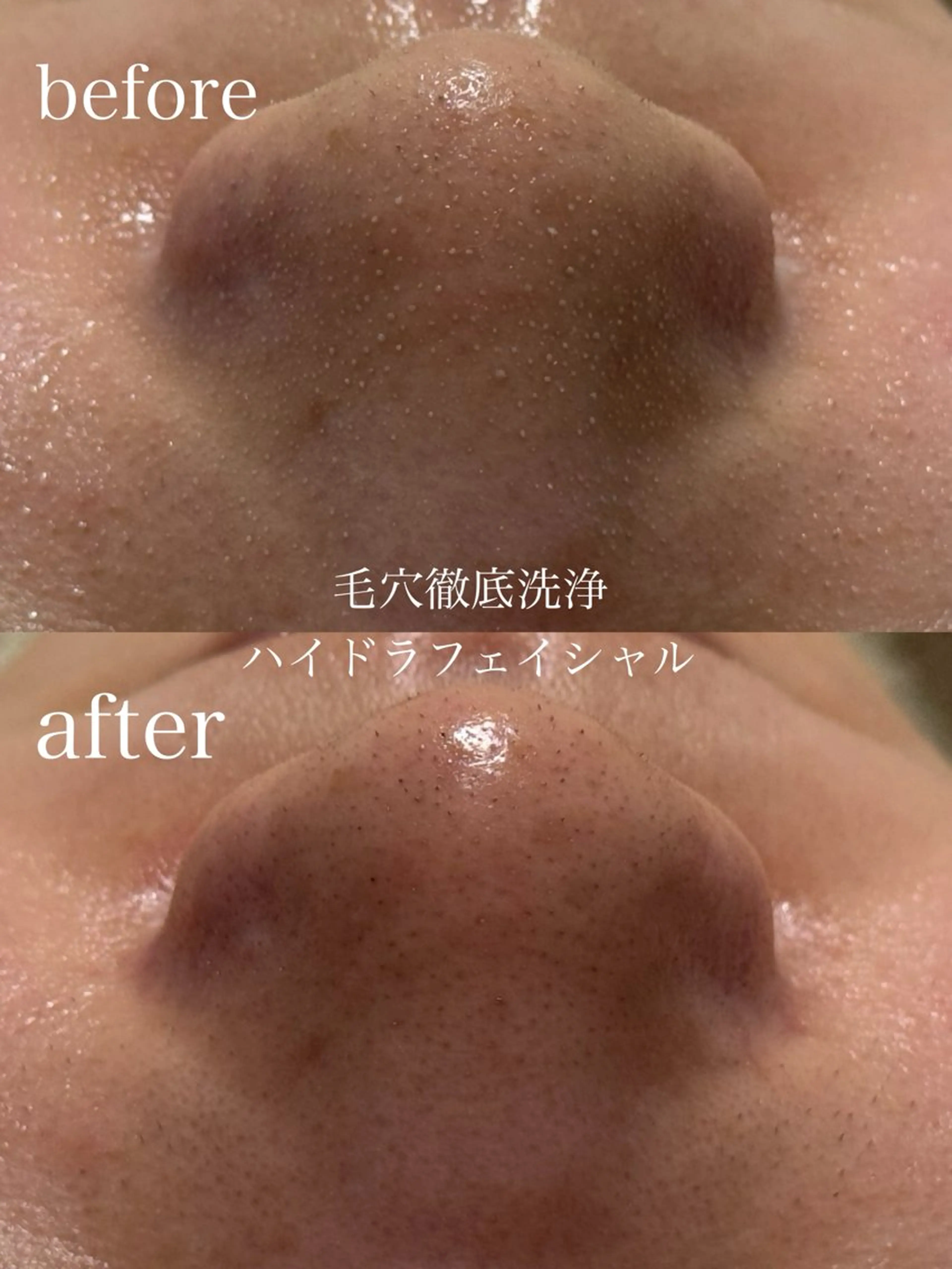 エステ フェイシャルサロン CHIARA鈴木のエステ・リラクイメージ