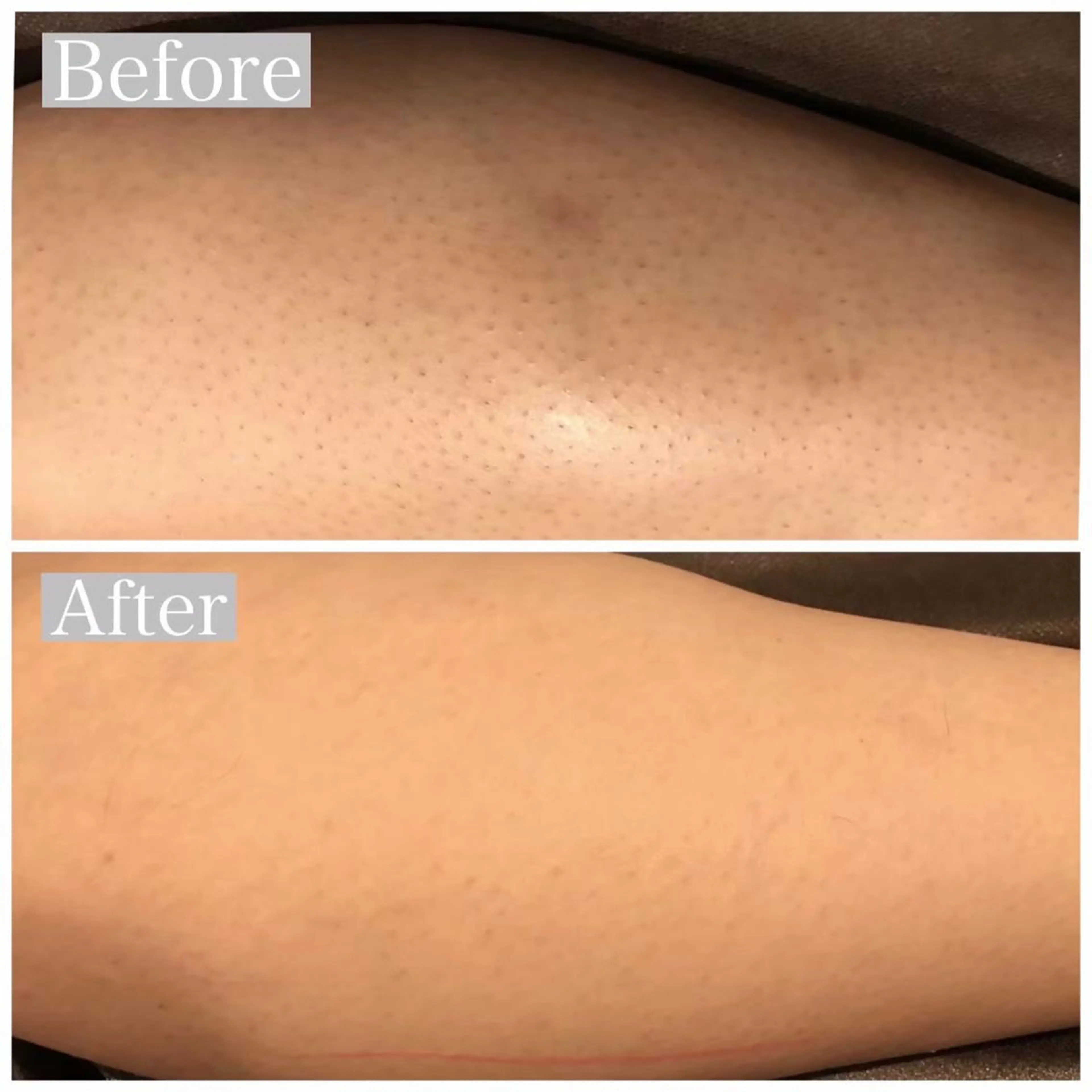 脱毛 ULULU 上野店のエステ・リラクイメージ