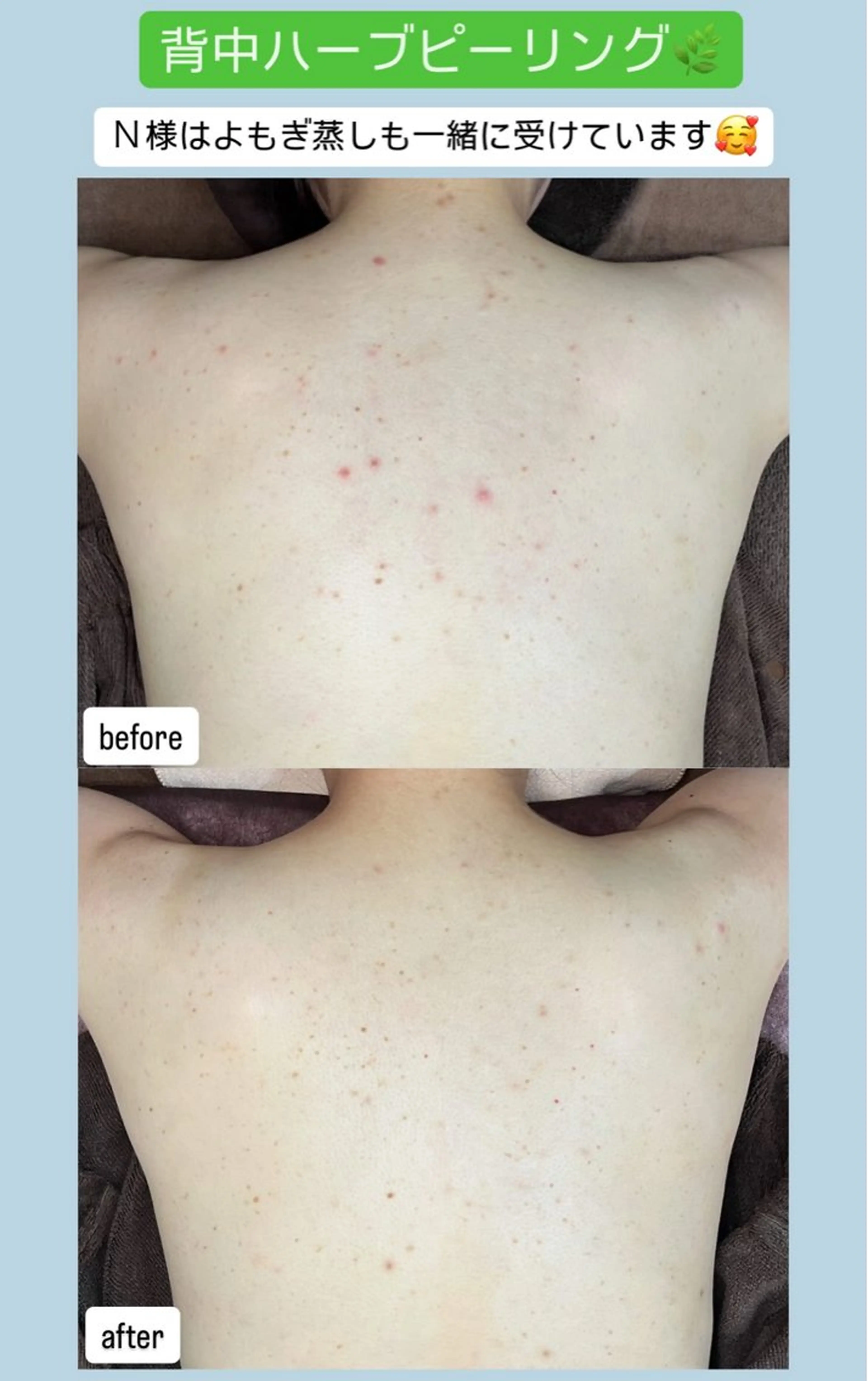 エステ ベラージュ【美背中・ 美尻・フェイシャル】のエステ・リラクイメージ